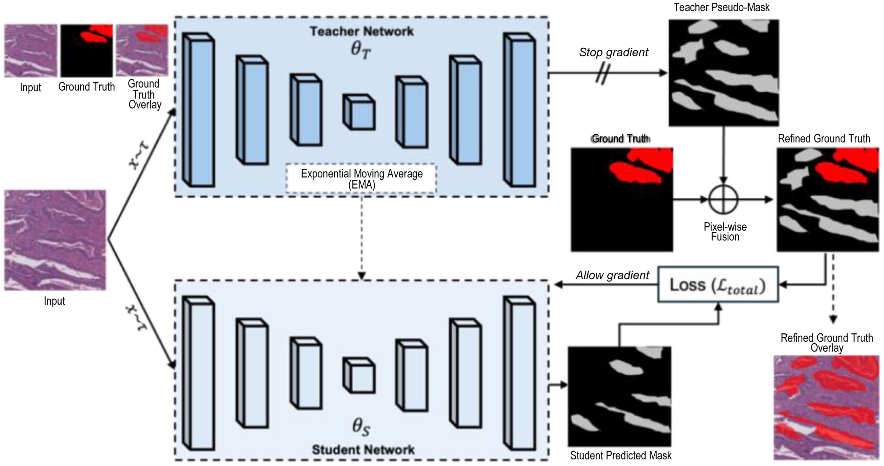 Schematic overview of the proposed teacher–student self-training framework for weakly supervised multi-class gland segmentation.