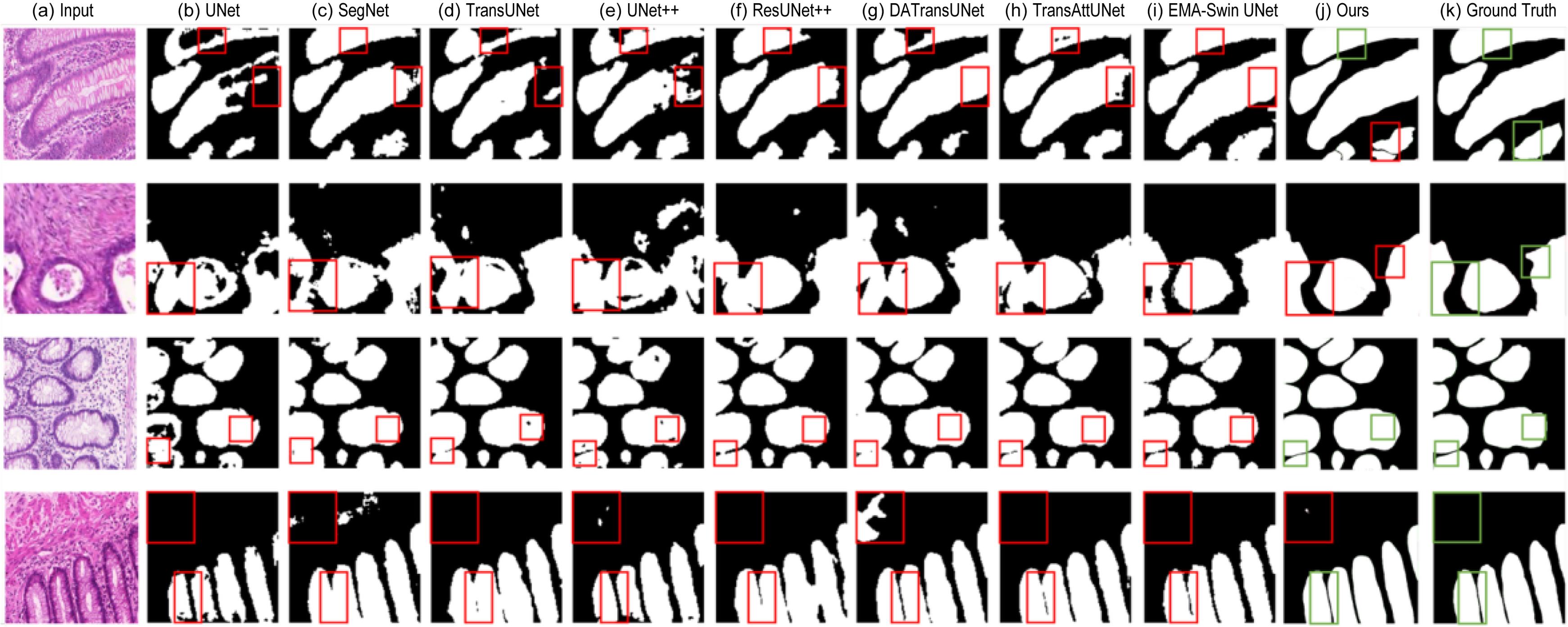 Results on the GlaS dataset.