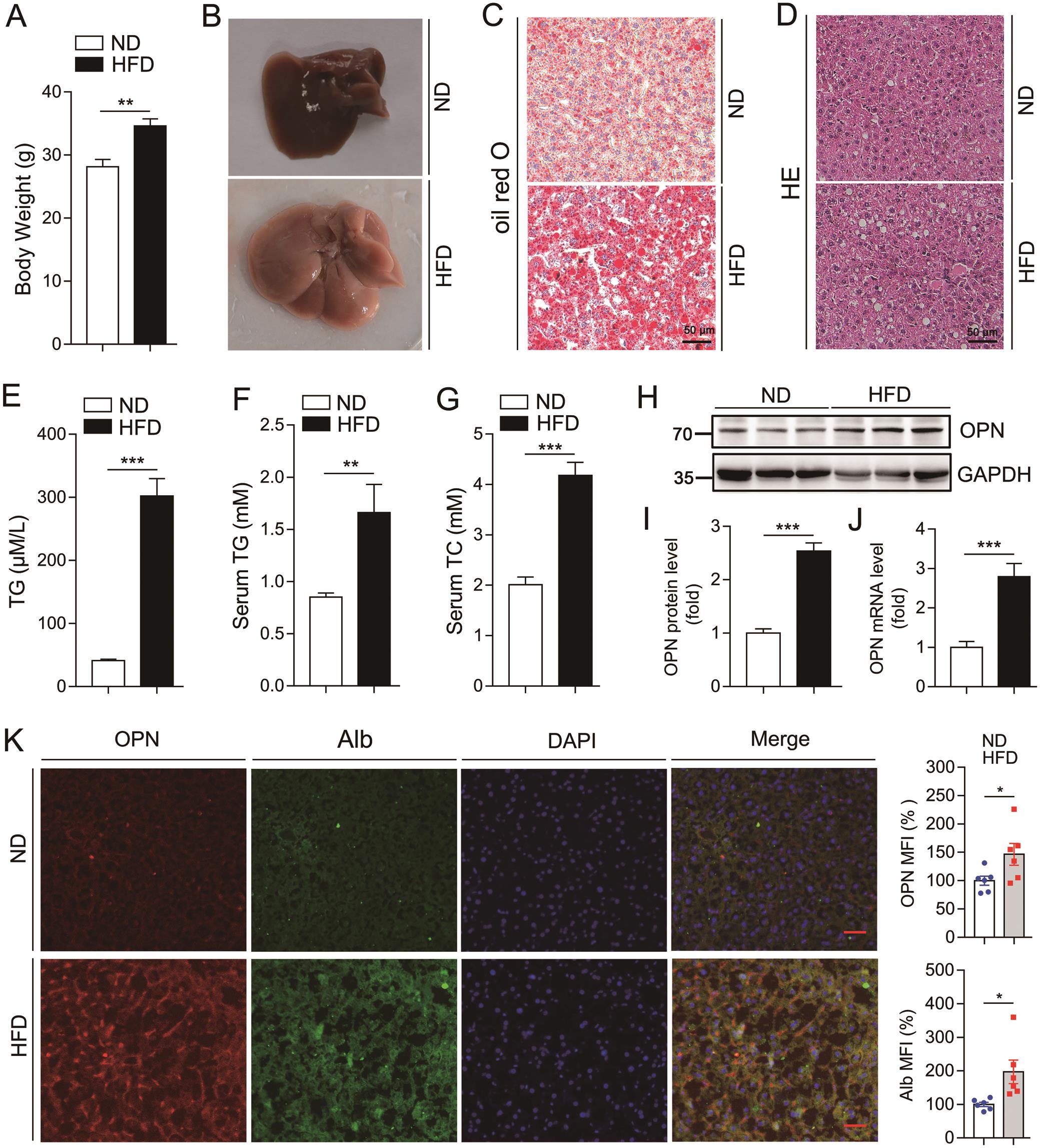 OPN level was increased in livers from mice with NAFLD.
