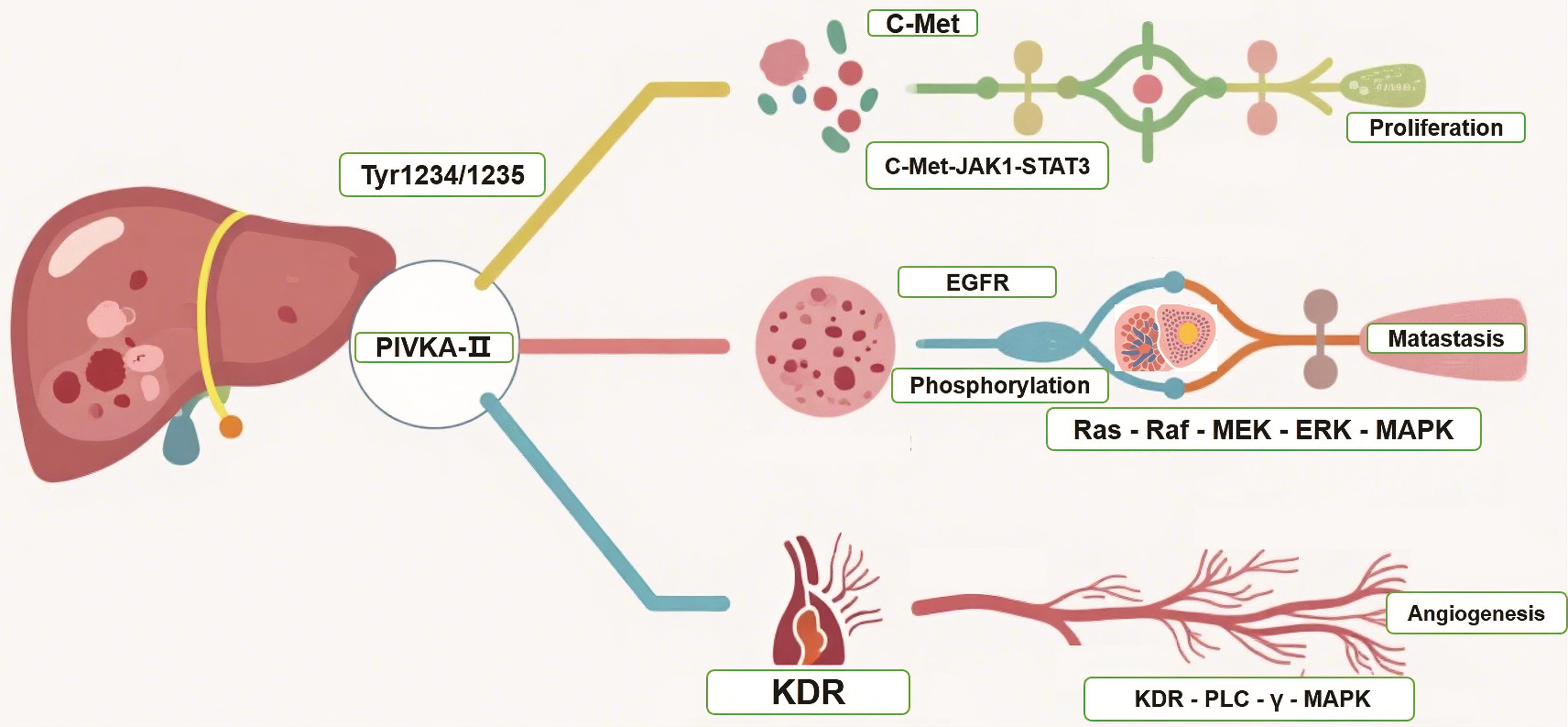 PIVKA-II promotes HCC progression.