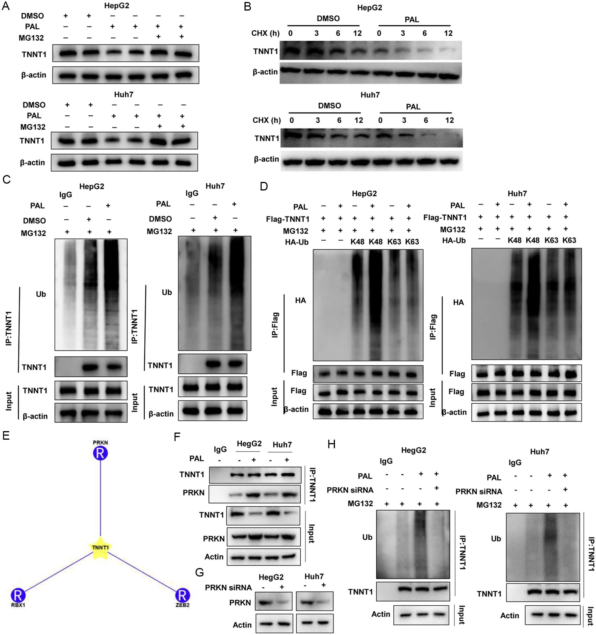 The effects of PAL on K48-linked polyubiquitination and protein stability of TNNT1.