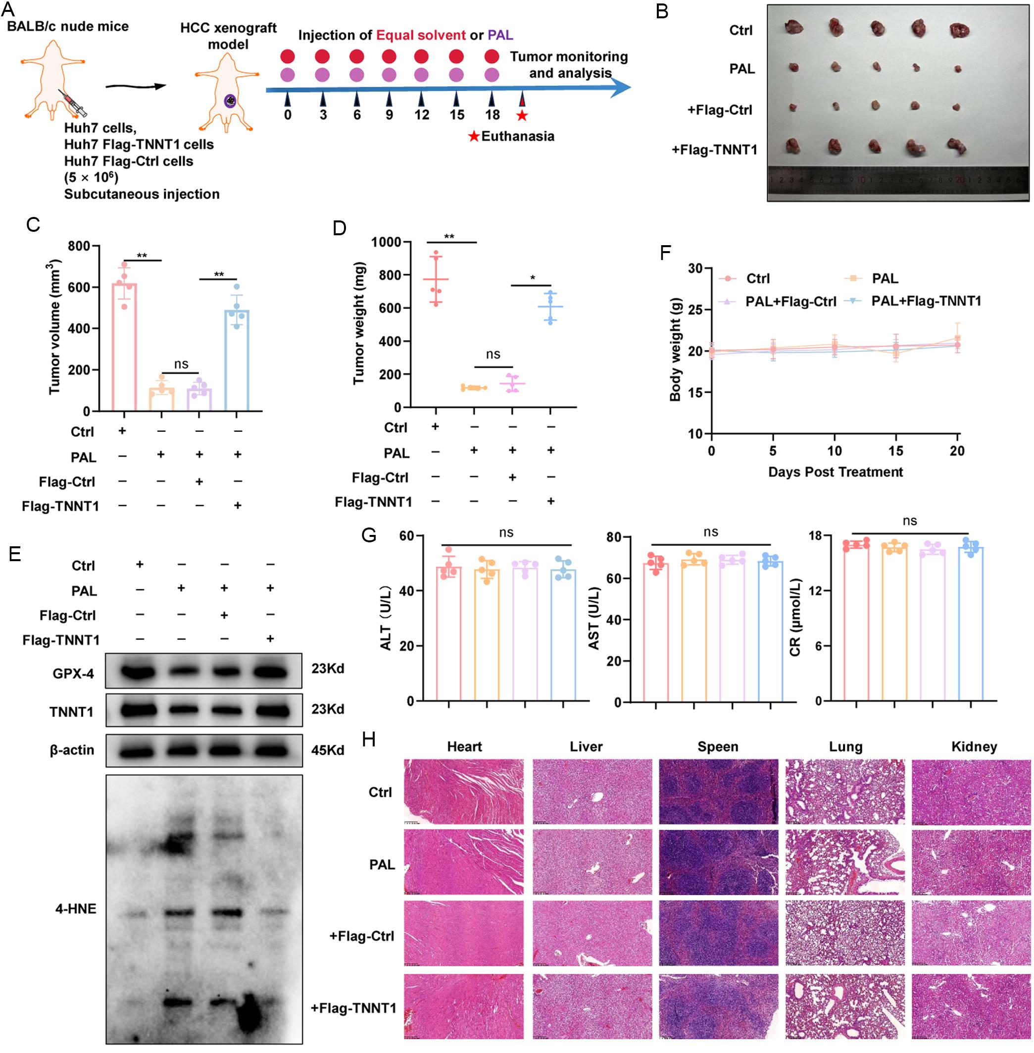 <italic>In vivo</italic> antitumor abilities of PAL against HCC.