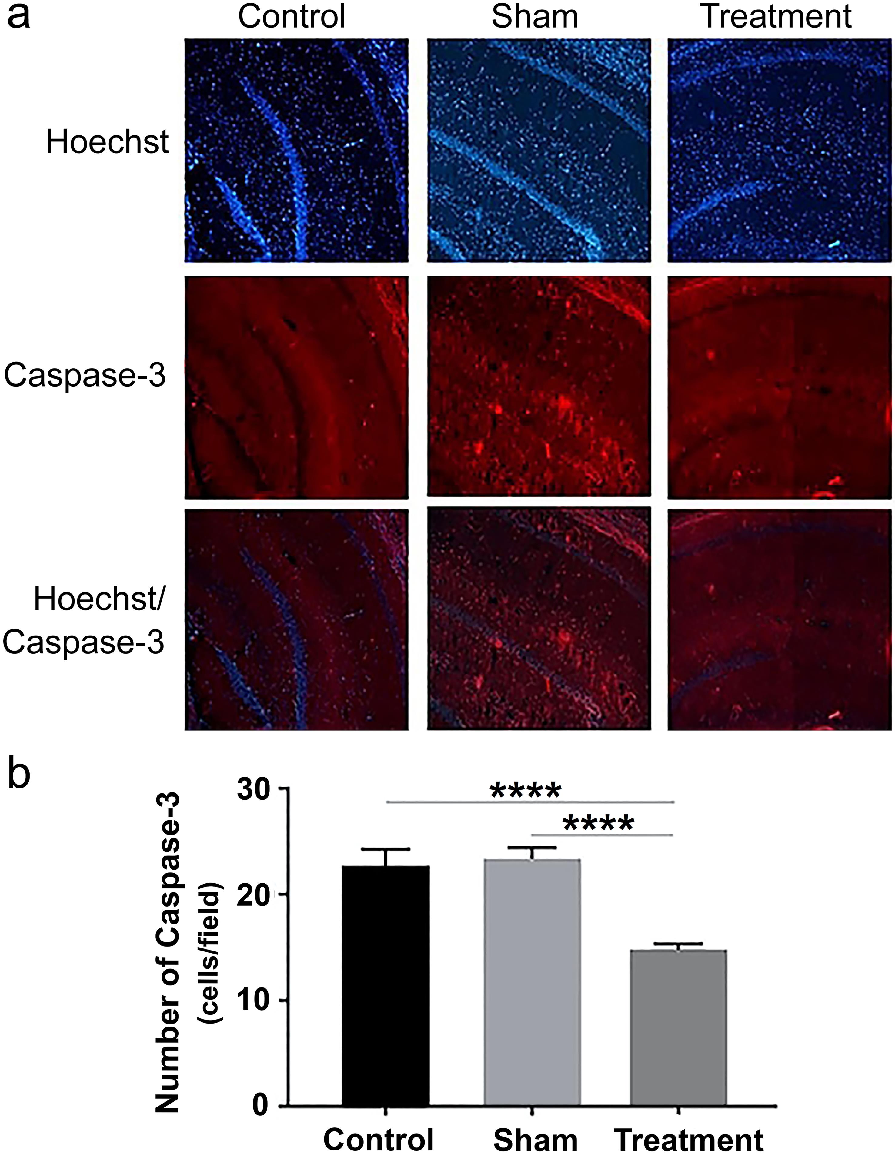 Immunohistochemical (IHC) staining showing the subcellular localization of caspase-3 using an anti-caspase-3 antibody in experimental groups.
