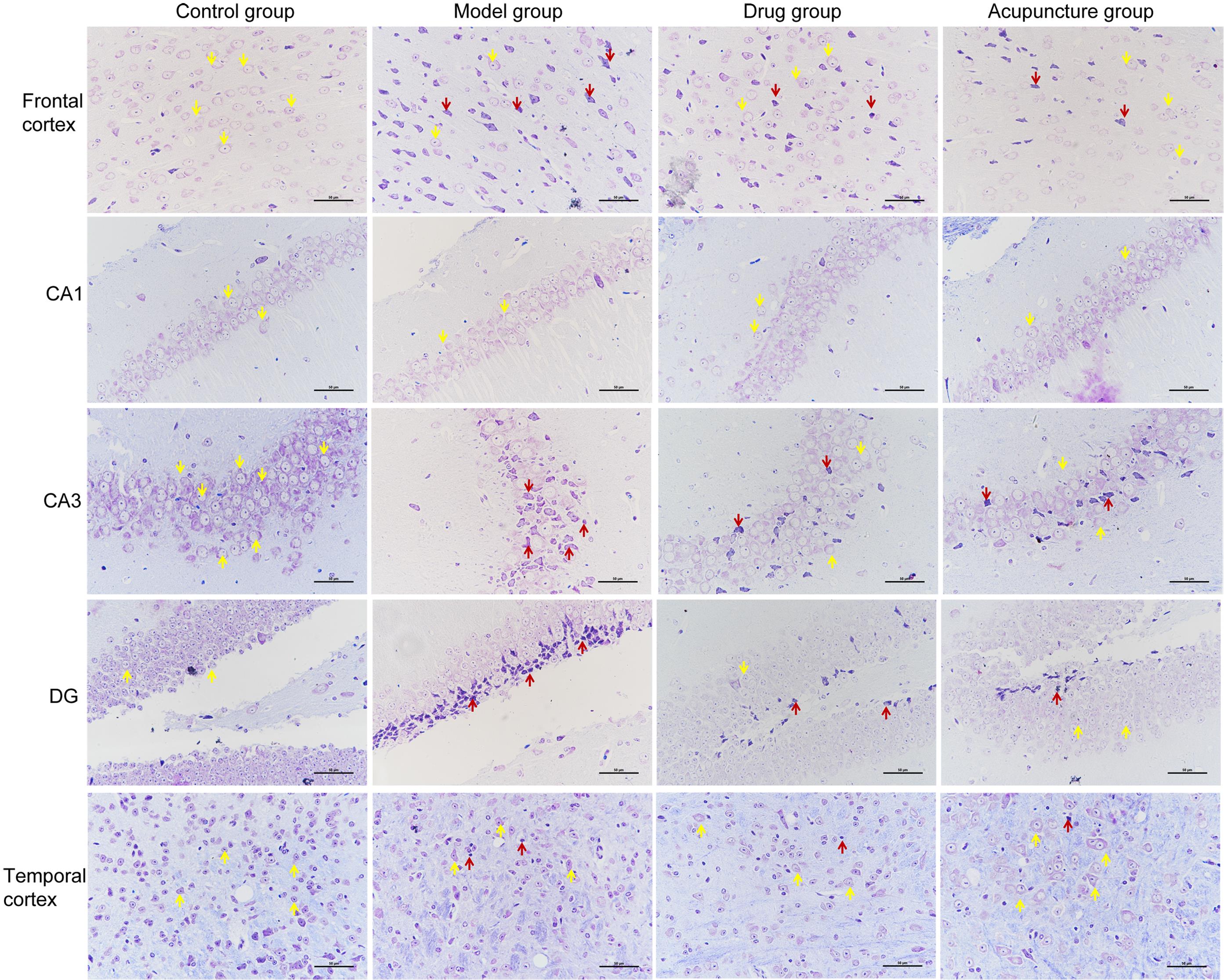 The effect of acupuncture on neurons in different brain regions.