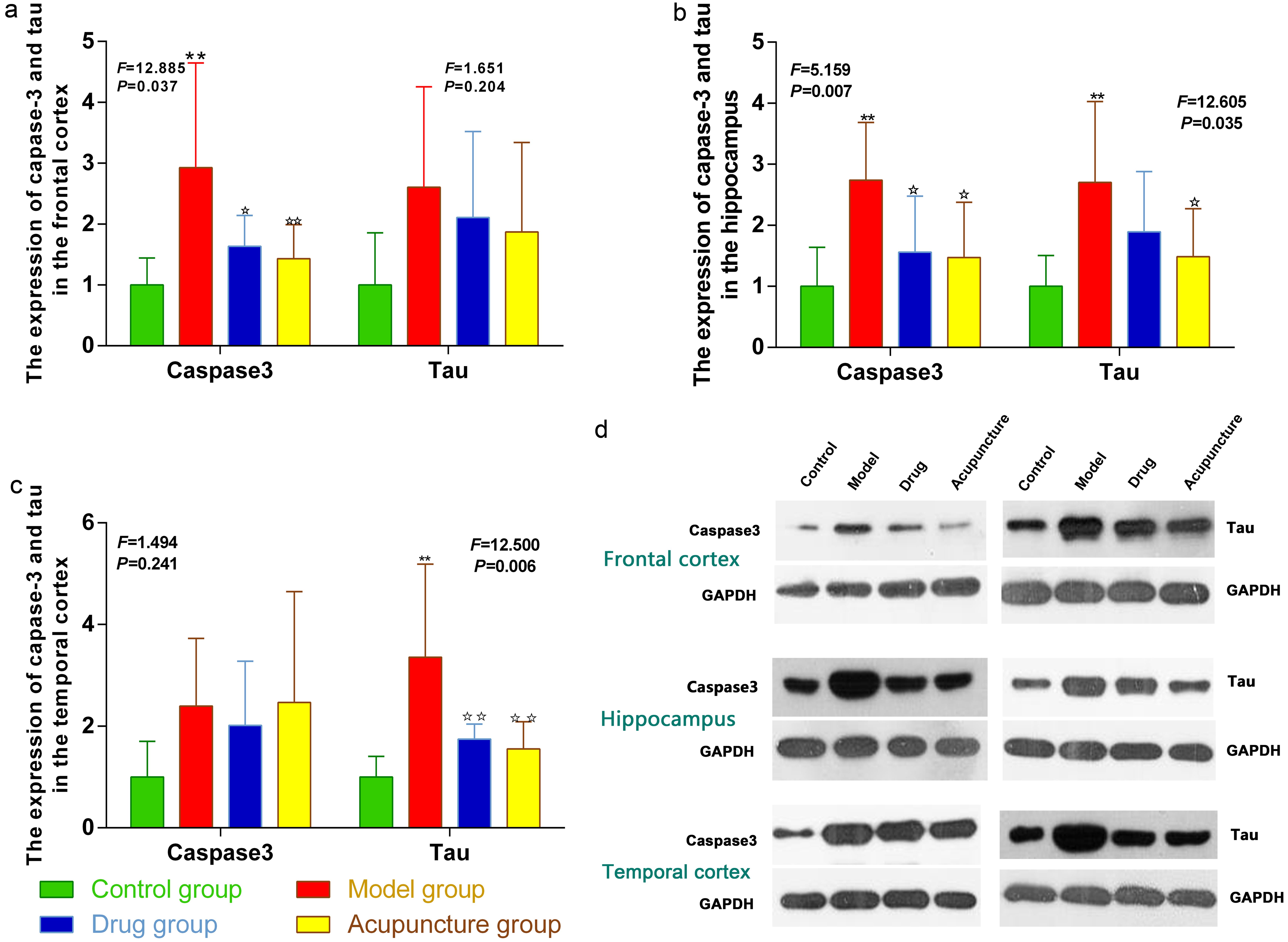 The effect of acupuncture on the content of Caspase-3 and tau protein in the frontal cortex, hippocampus, and temporal cortex.