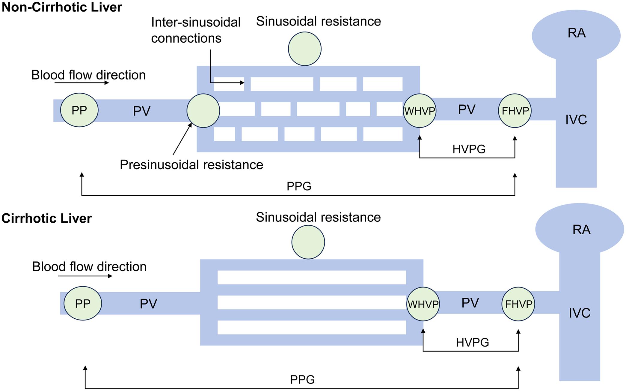 Direct and indirect measurement of portal vein pressure.