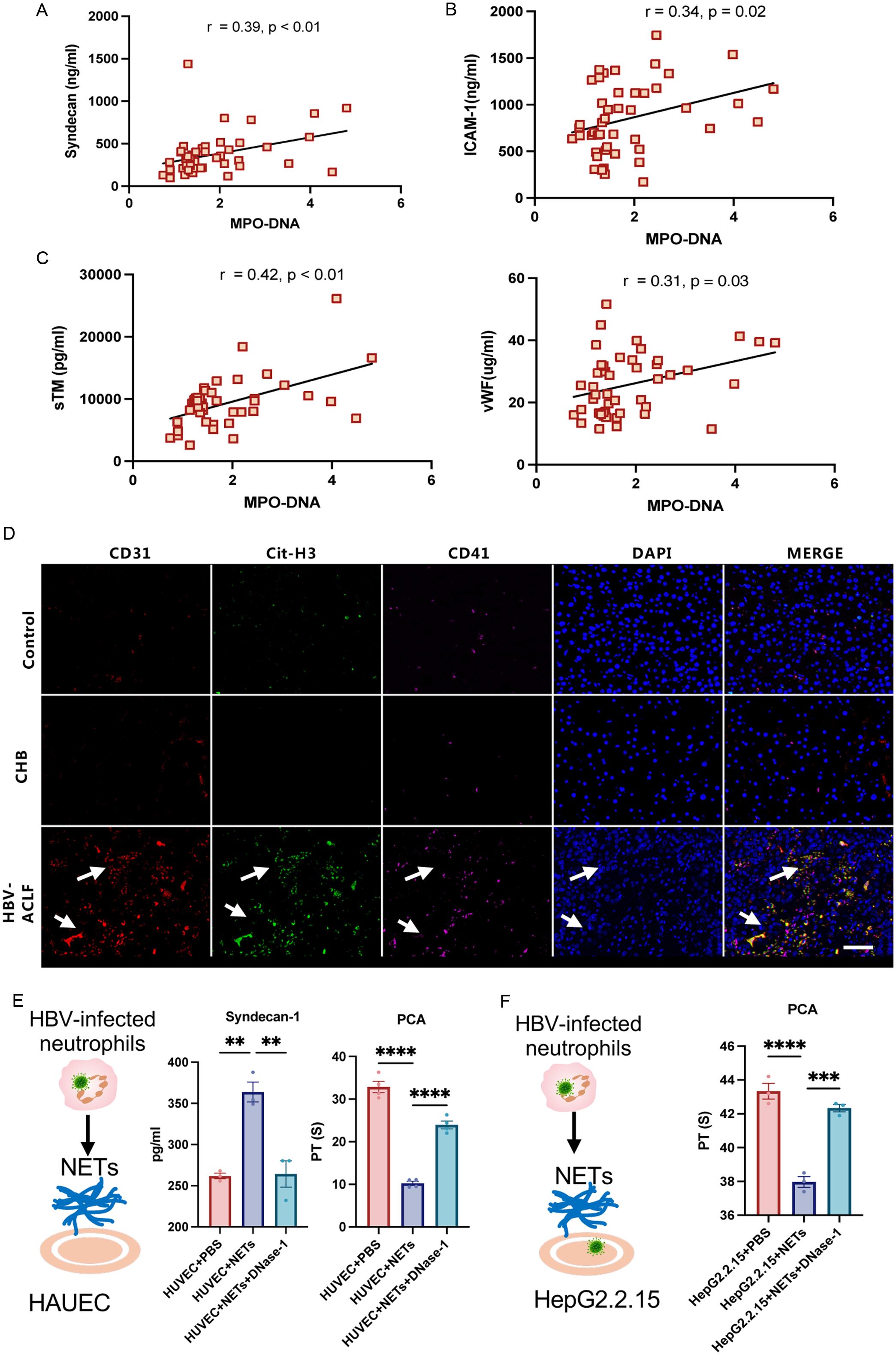 NETs markers, endothelial injury biomarkers, and coagulation parameters in HBV-ACLF.