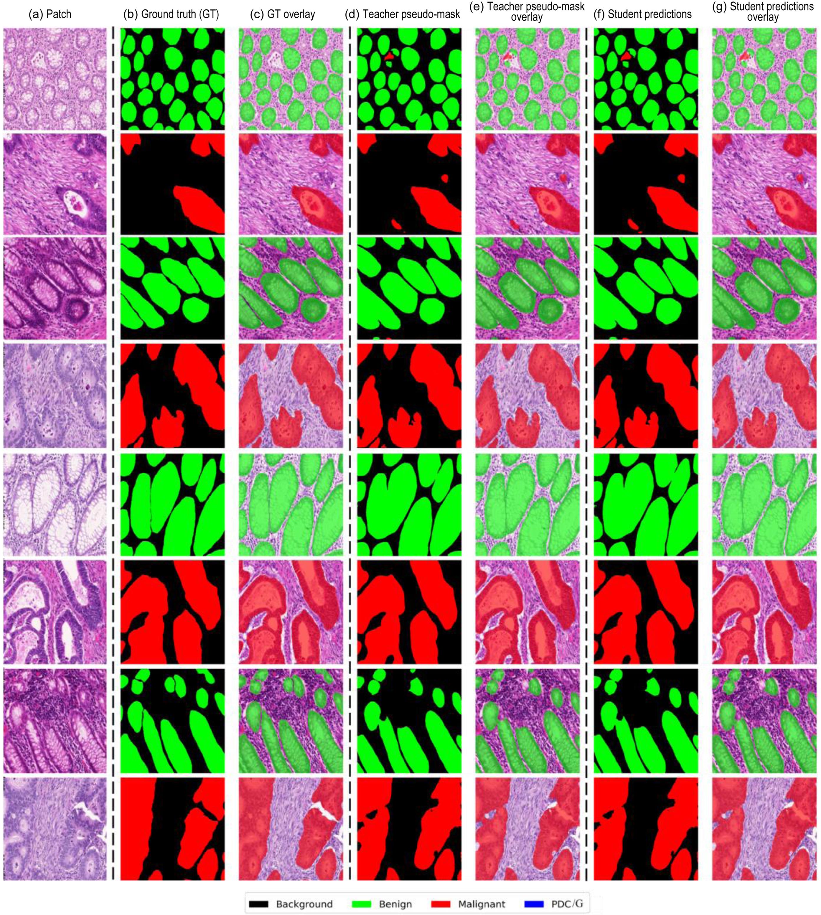 Qualitative results on the GlaS test set.