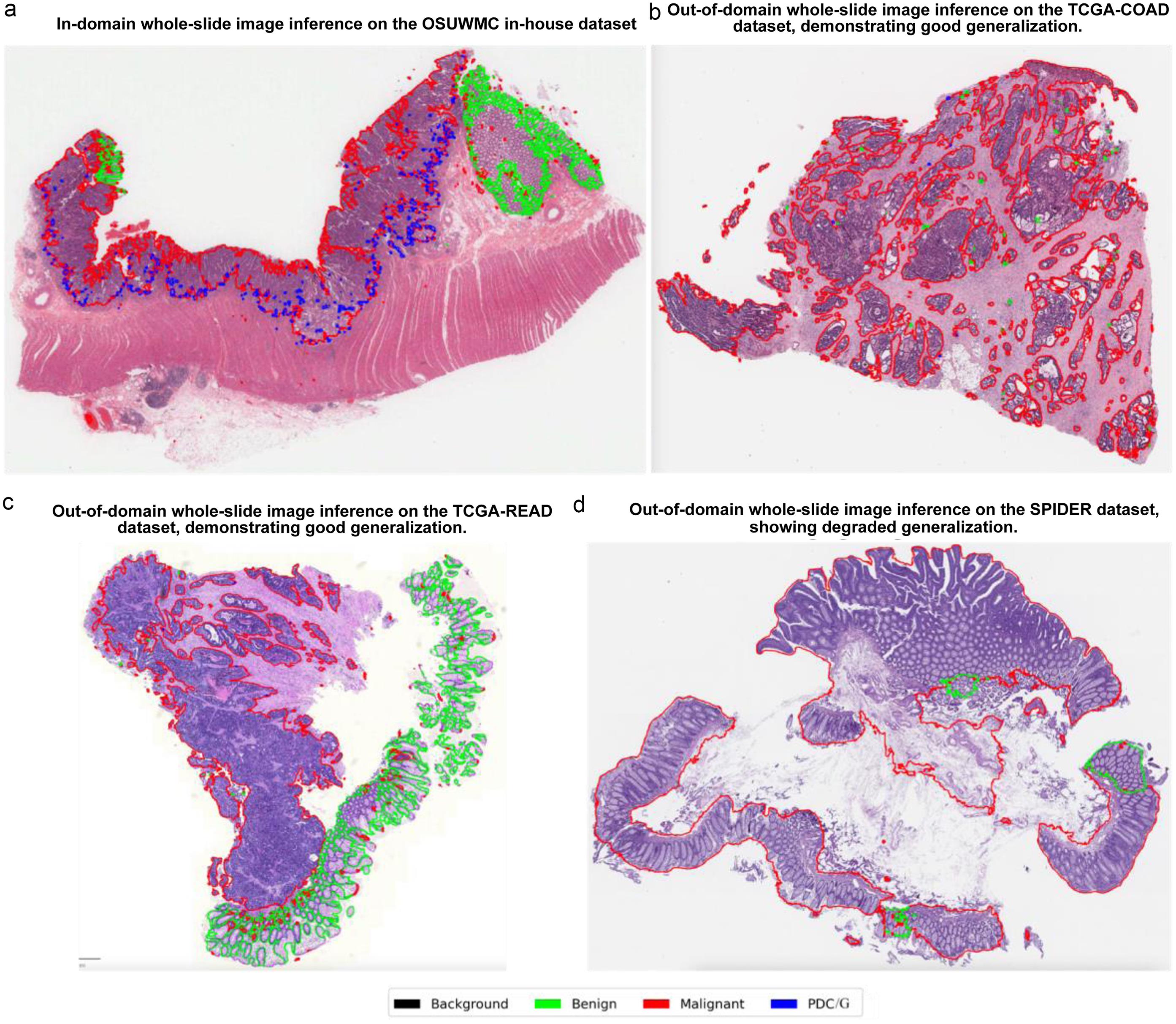 Whole-slide–level qualitative assessment across (a) in-house OSUWMC, (b) TCGA-COAD (The Cancer Genome Atlas Colon Adenocarcinoma), (c) TCGA-READ (Rectal Adenocarcinoma), and (d) SPIDER, illustrating cross-domain generalization.