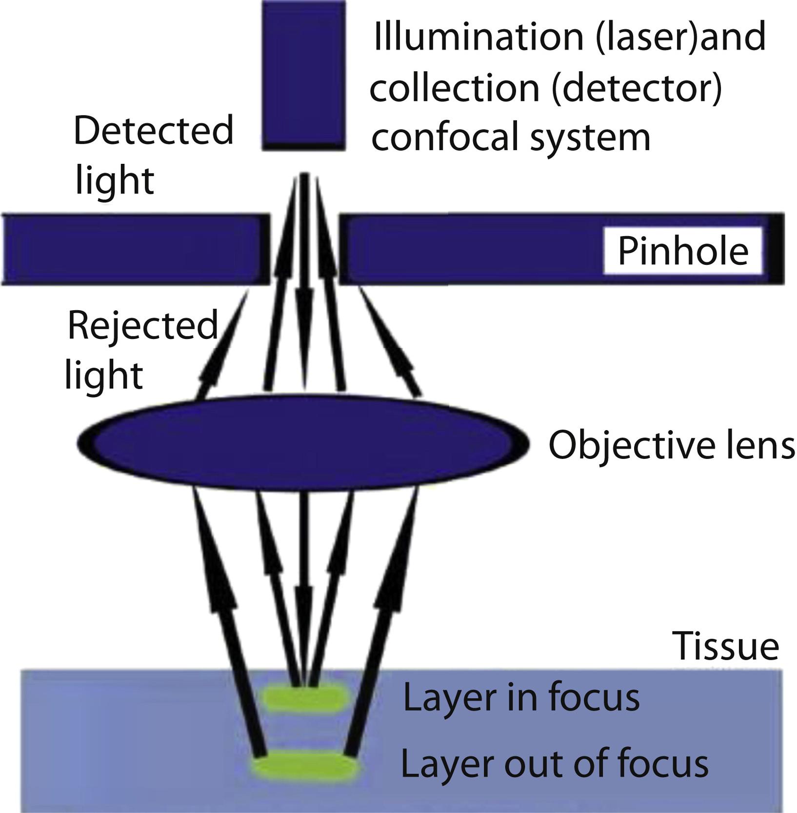 Basic technical principle of confocal laser endomicroscopy.