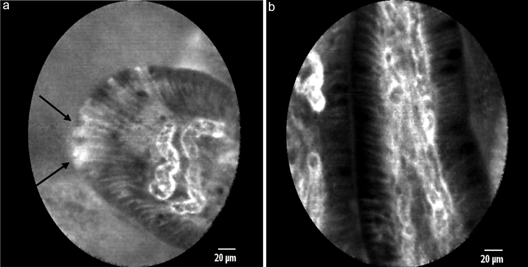 Representative pCLE images of duodenal villi.