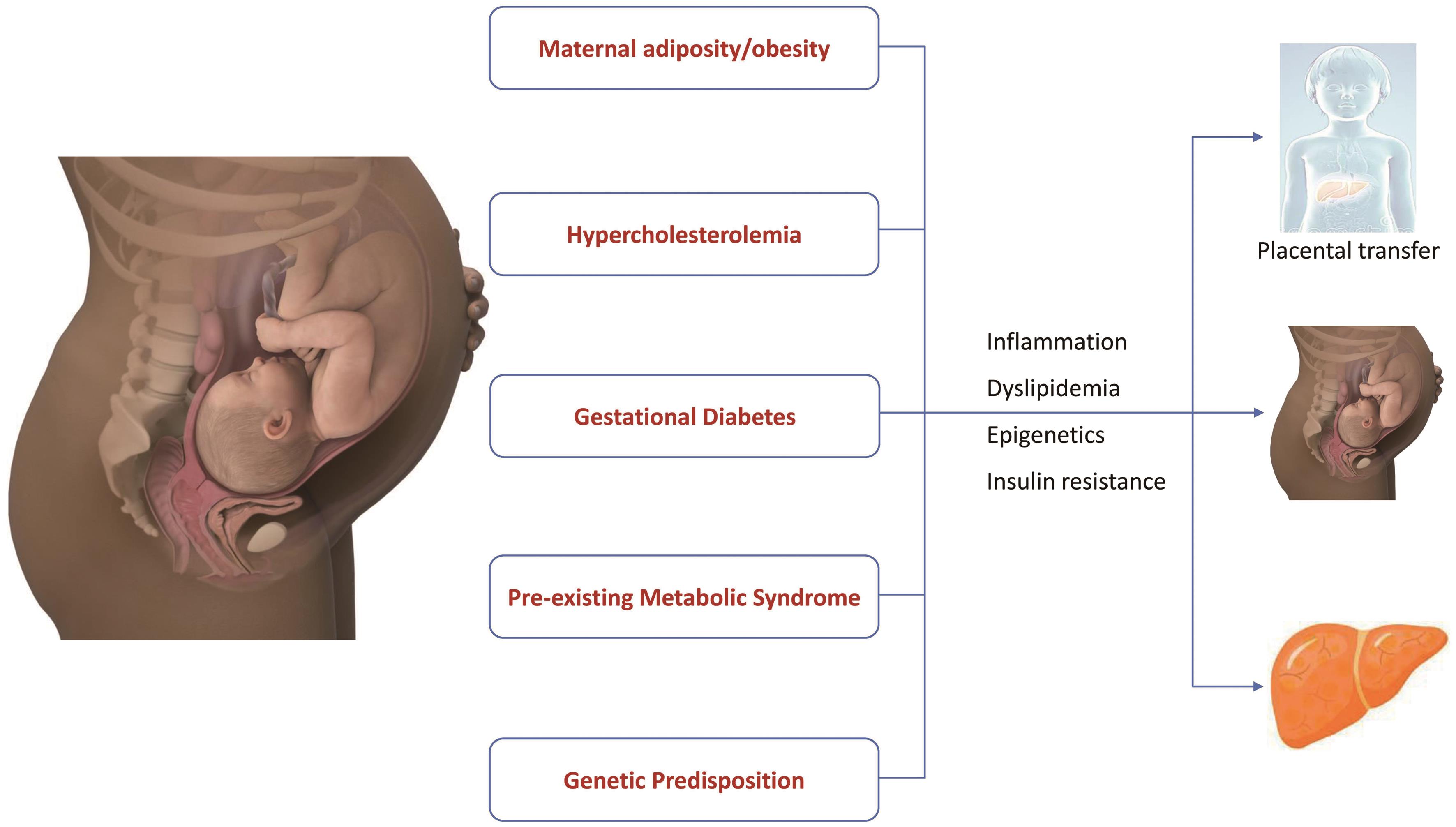 The effects of pregnancy on MAFLD development.