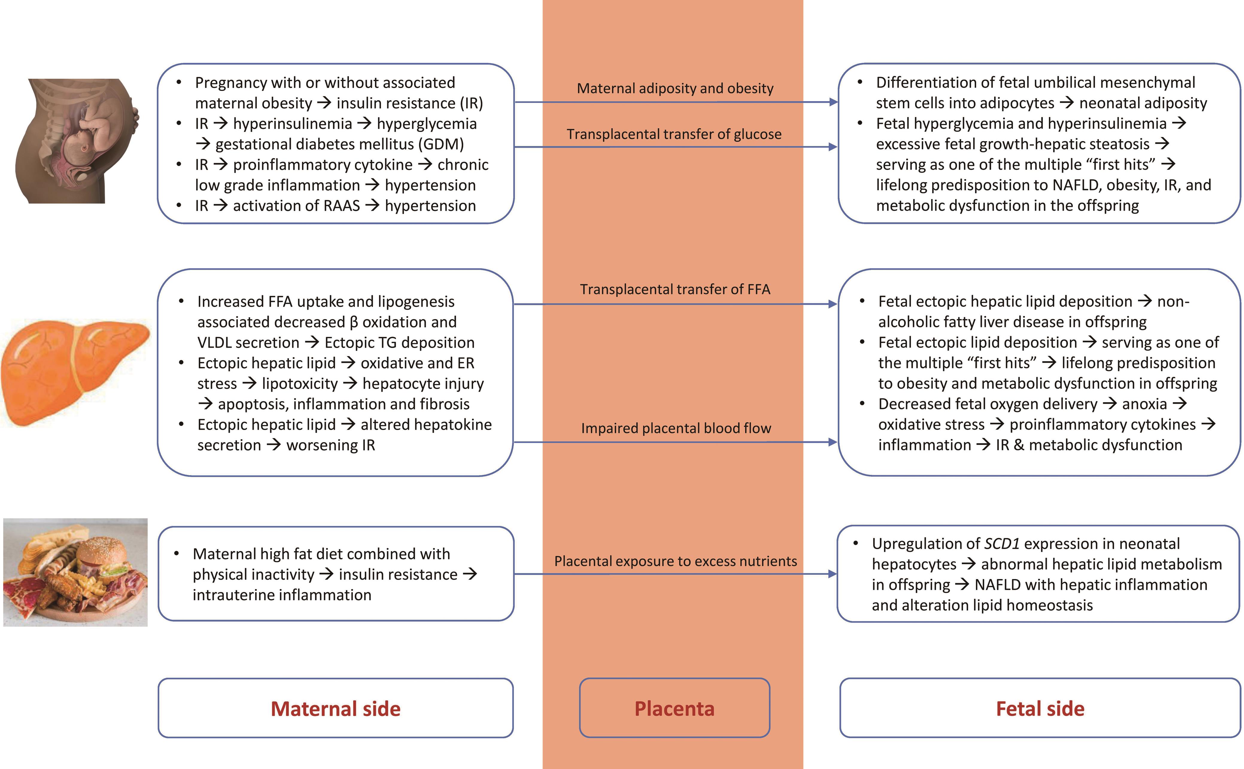 Effects of metabolic dysregulation of pregnancy, MAFLD and maternal nutritional factors on the fetus.