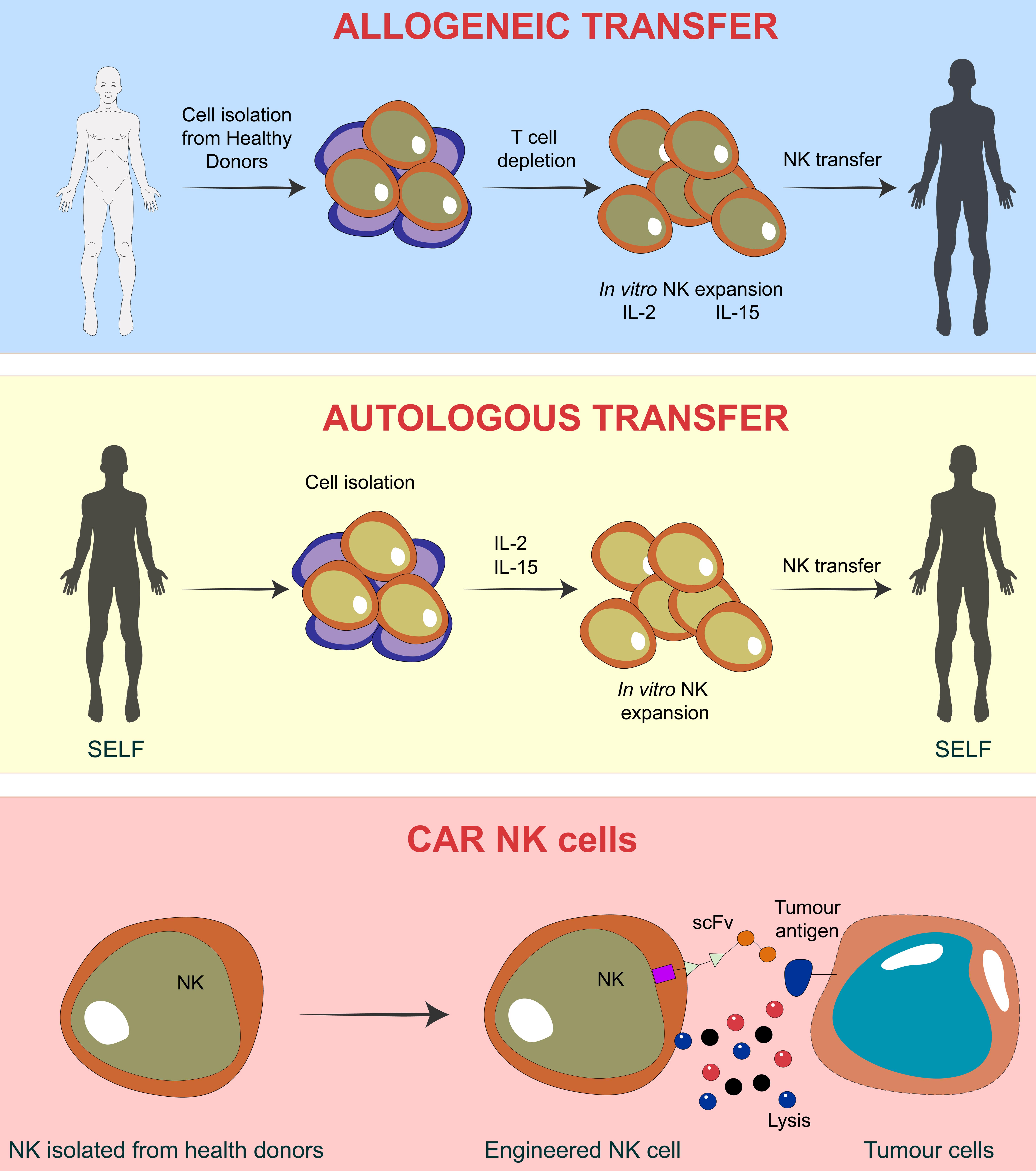 Schematic representation of adoptive NK cell transfer for AML patient.