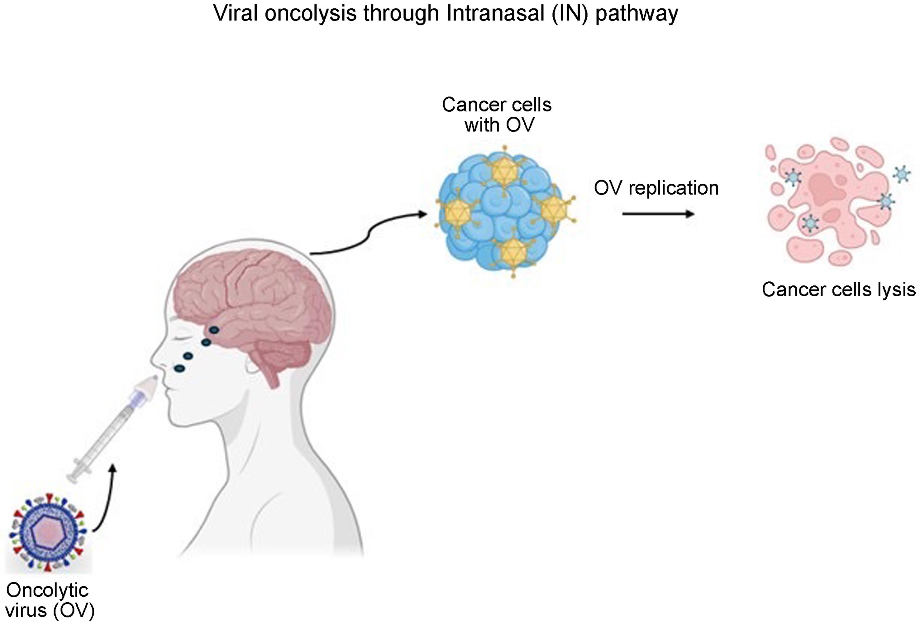 Representation of viral oncolysis via intranasal pathway (IN).