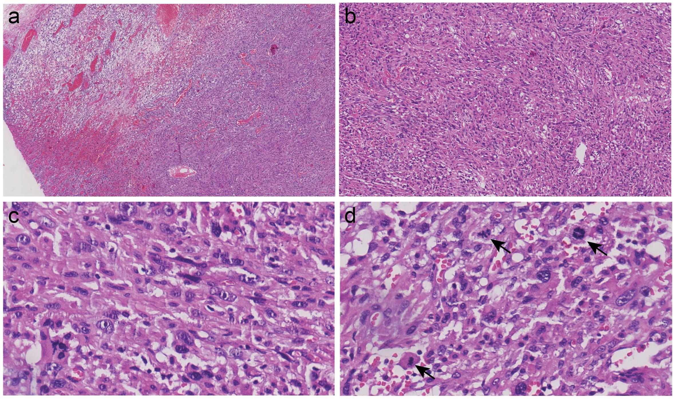 Representative hematoxylin and eosin staining.