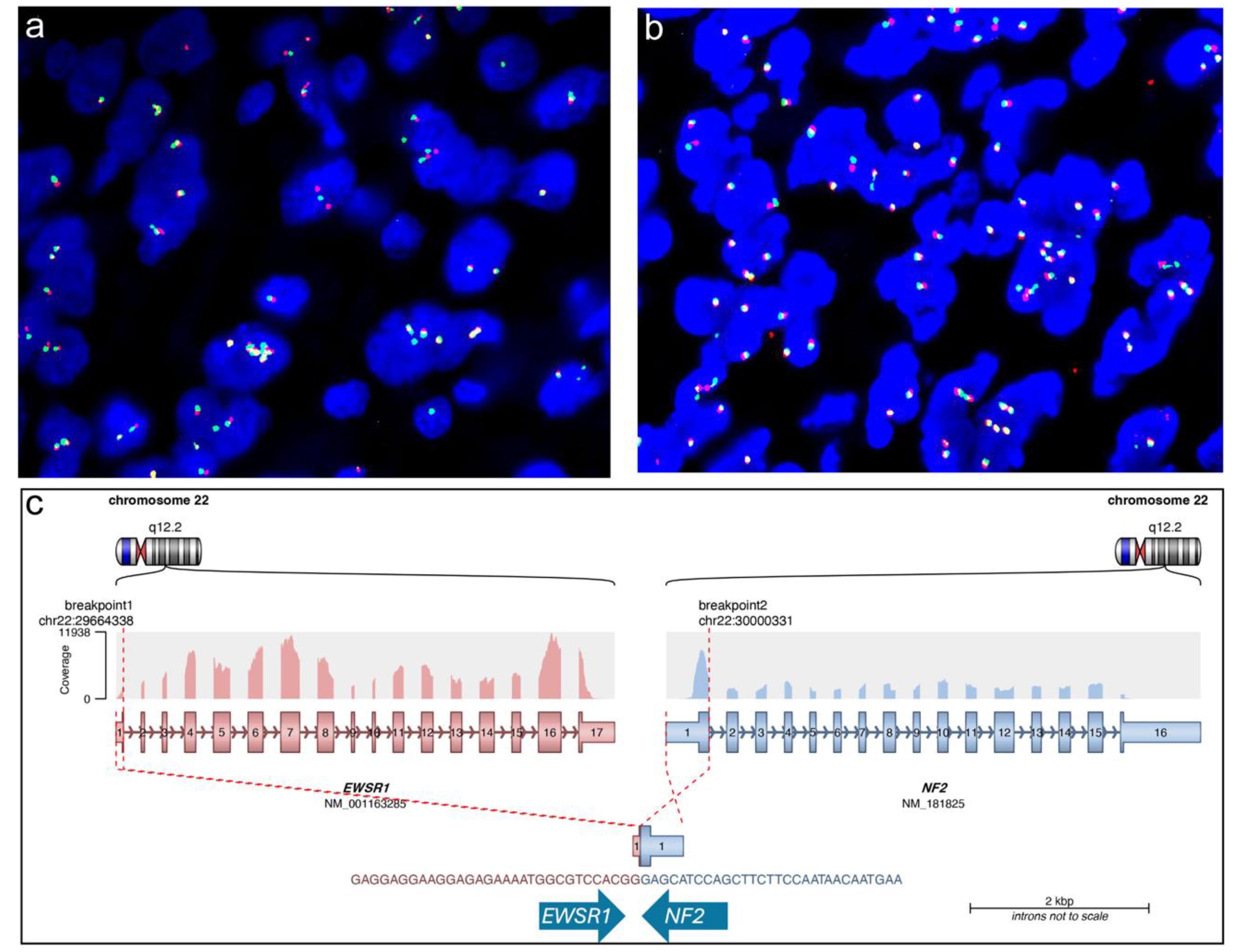 Molecular analyses of the tumor.
