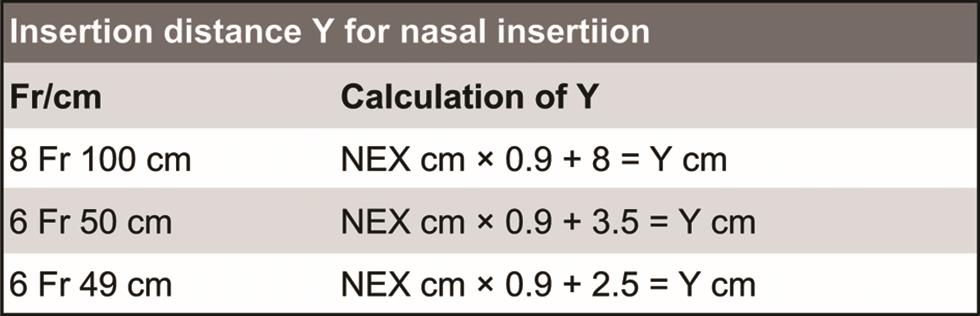 Insertion distance for nasogastric Edi Catheter. 
