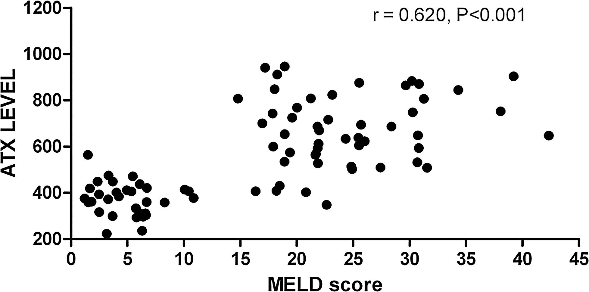 Relationship between serum ATX levels and MELD score in hepatitis B-related LC and ACLF patients.