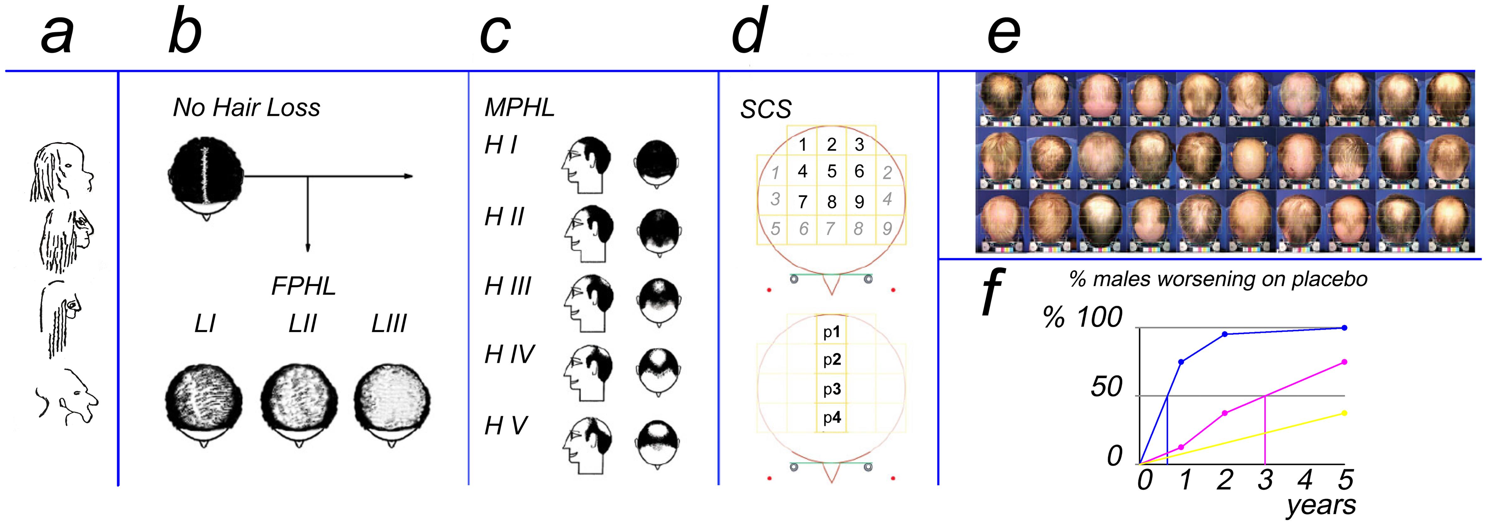Clinical schemes and Scalp Segmentation for hair loss estimation.