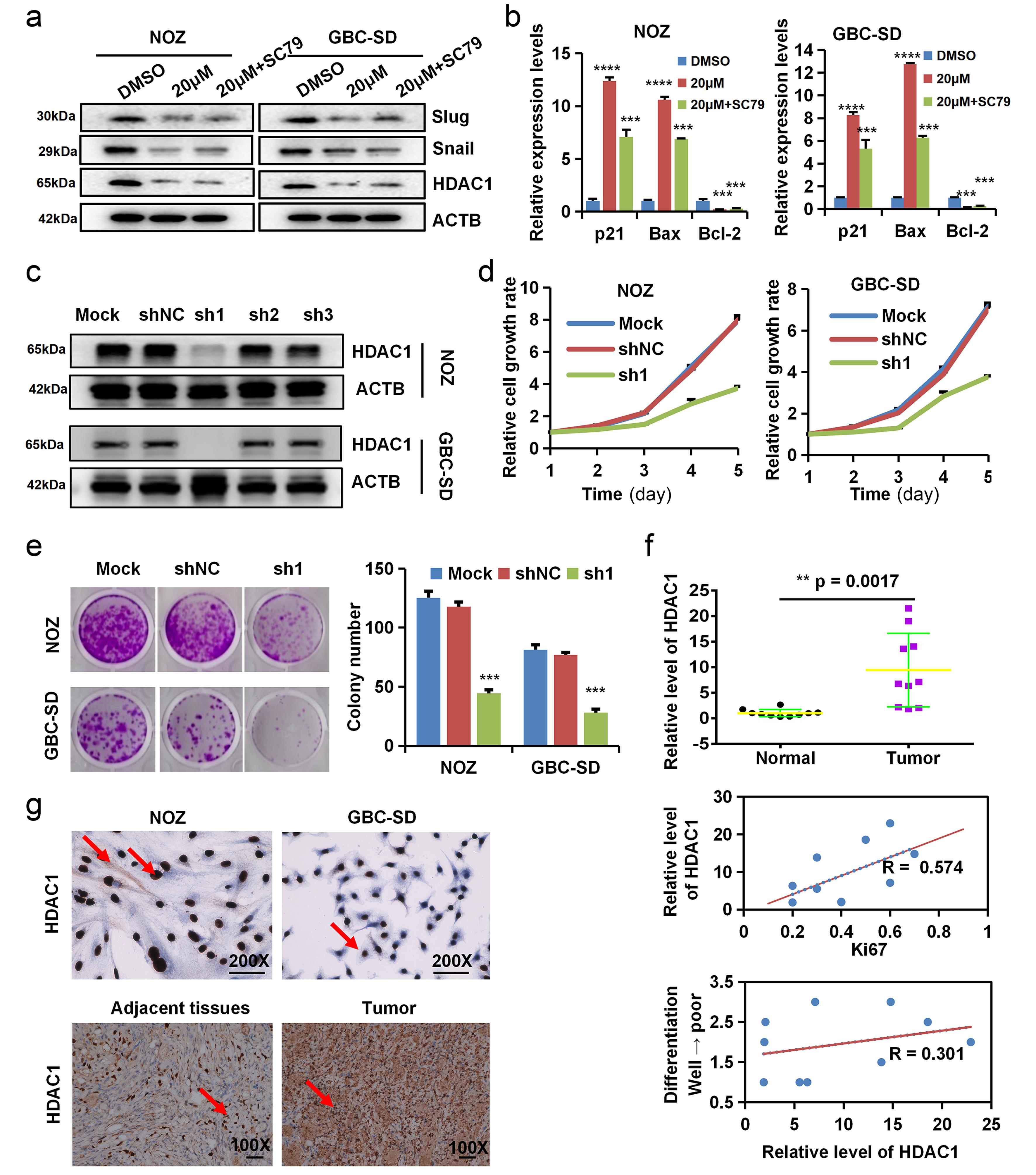 Apatinib regulates downstream target genes through HDAC1.