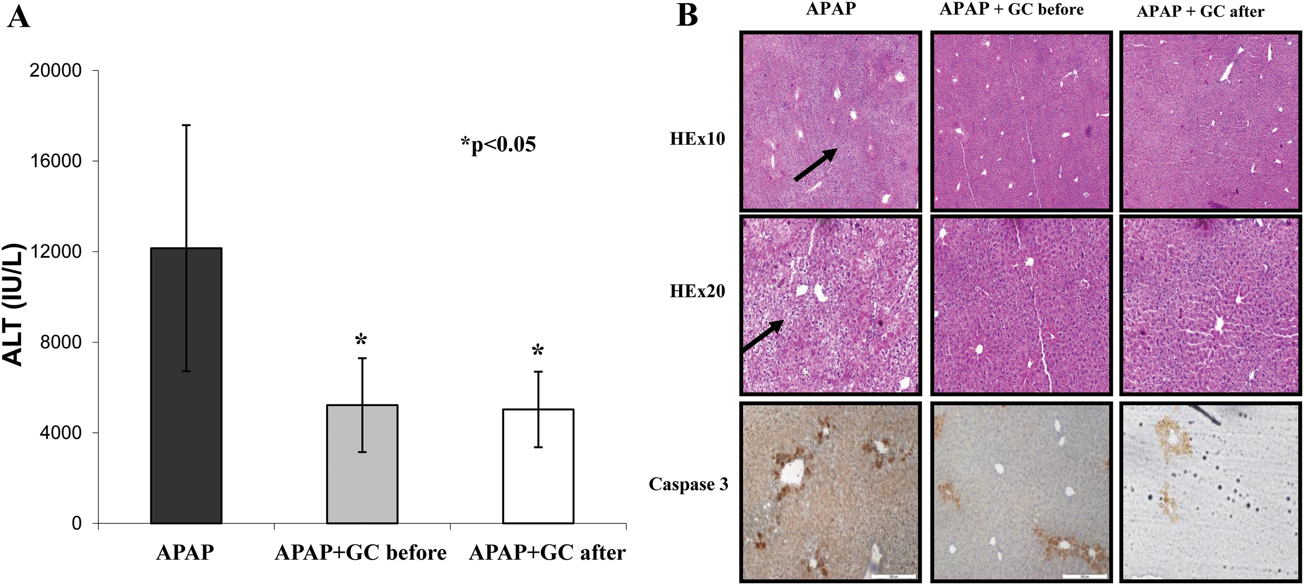 Protective effect of β-glucosylceramide from APAP-mediated liver damage.