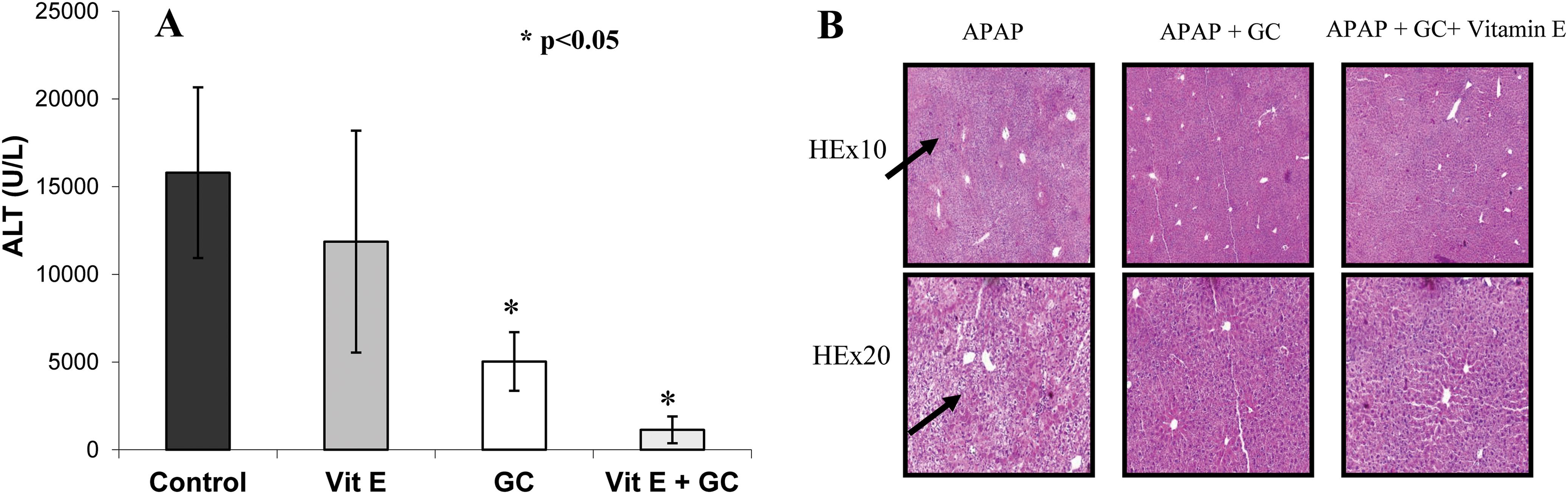 Synergistic effect of β-glucosylceramide with vitamin E on alleviation of the APAP-mediated liver damage.