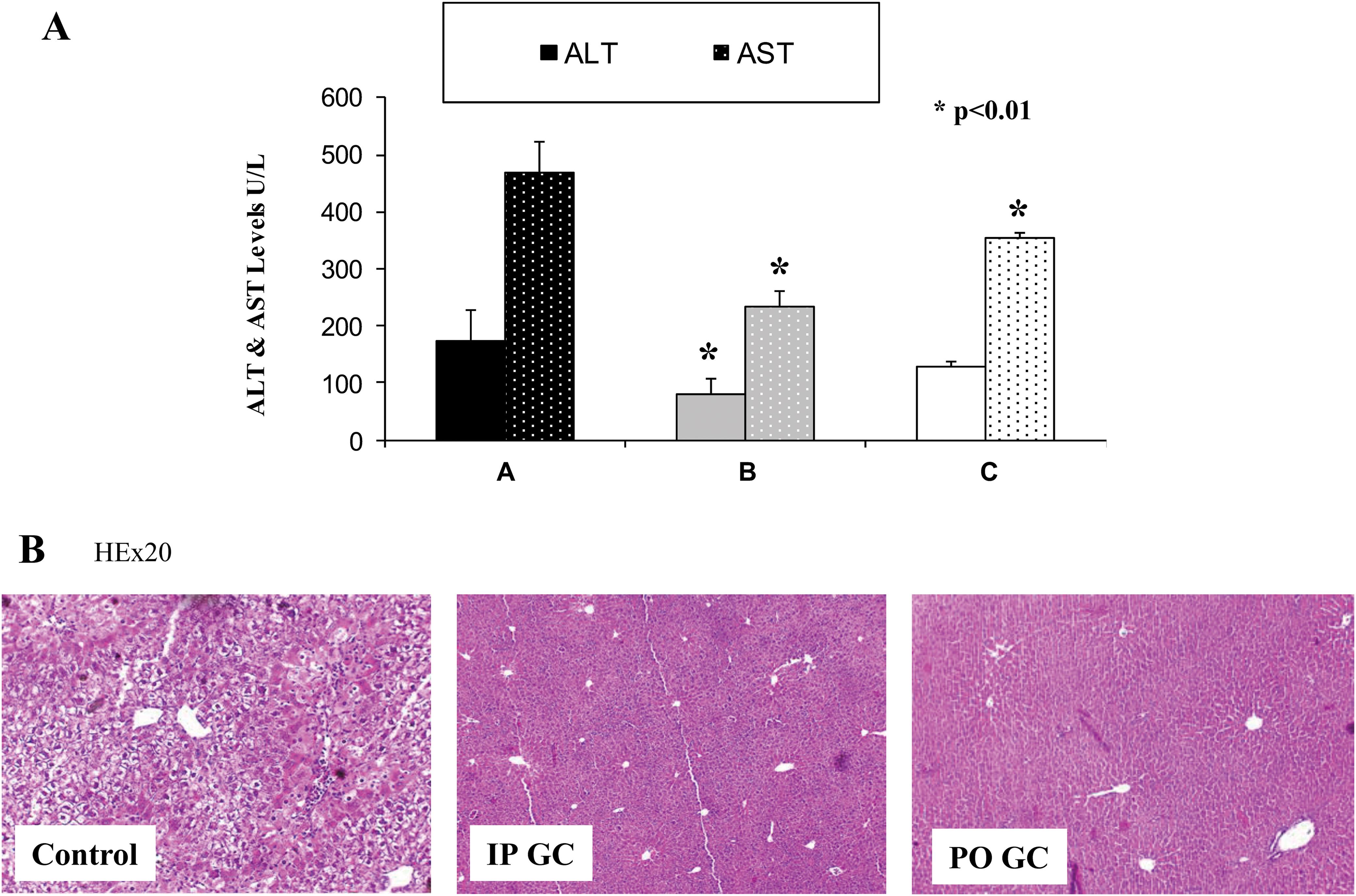 Protective effect of β-glucosylceramide from statin-mediated liver damage.