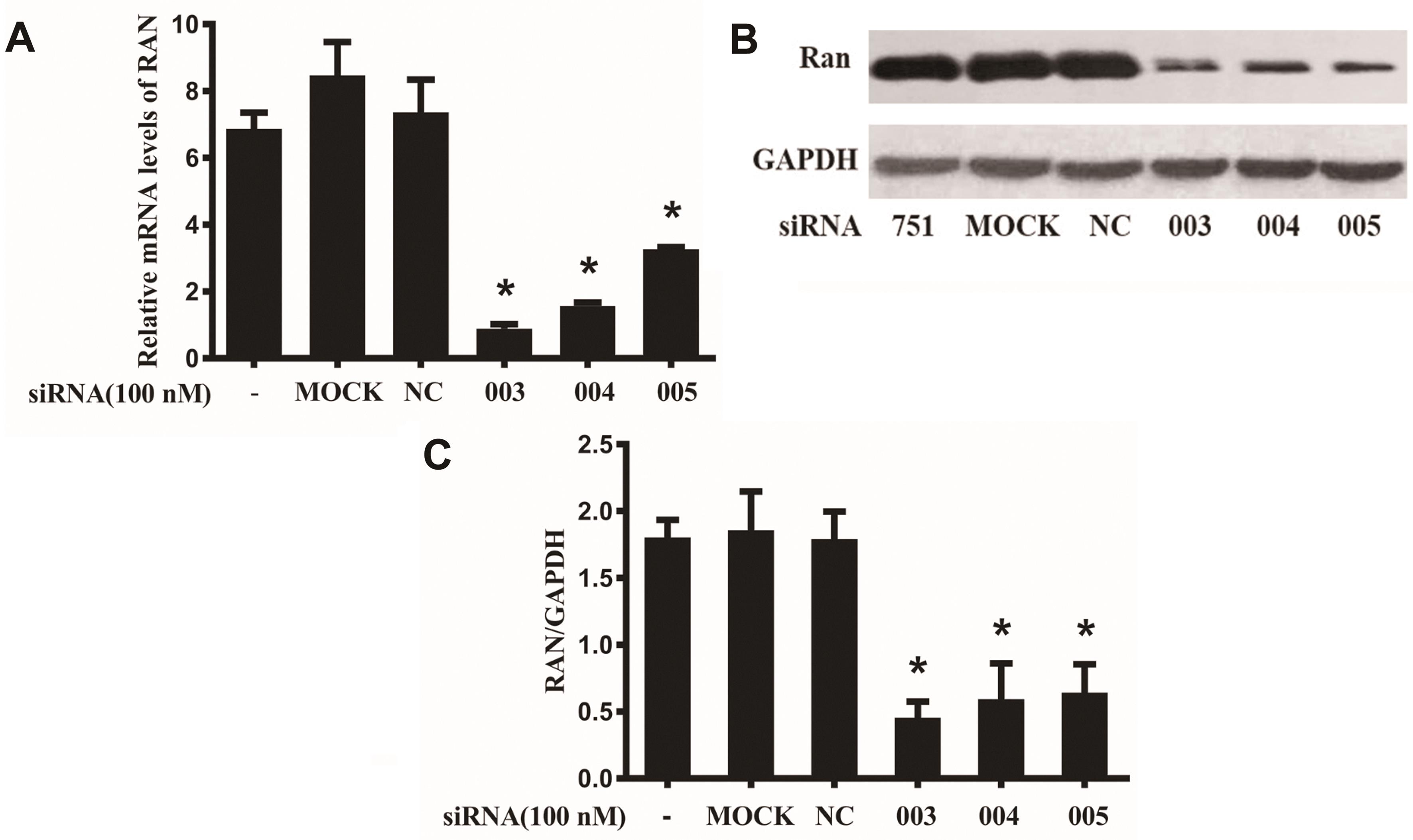 Silencing effects of siRNAs on the mRNA and protein expression levels of RAN. Huh7.5.1 cells were treated with siRNAs specific to RAN (003, 004 and 005); an irrelevant siRNA (NC) was used as a control in each experiment.
