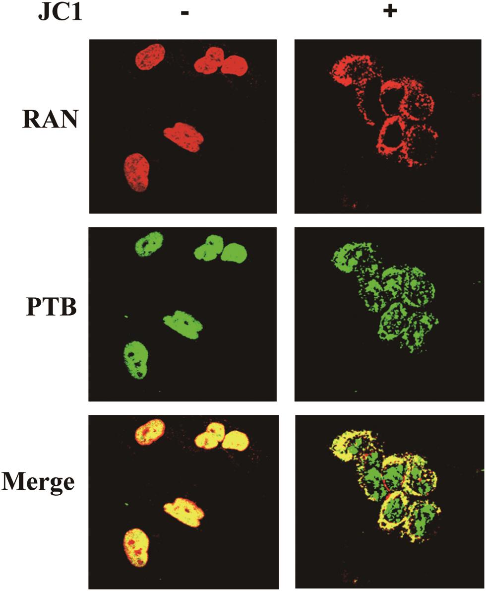Colocalization of RAN with PTB on Huh7.5.1 cells infected with JC1 virus.