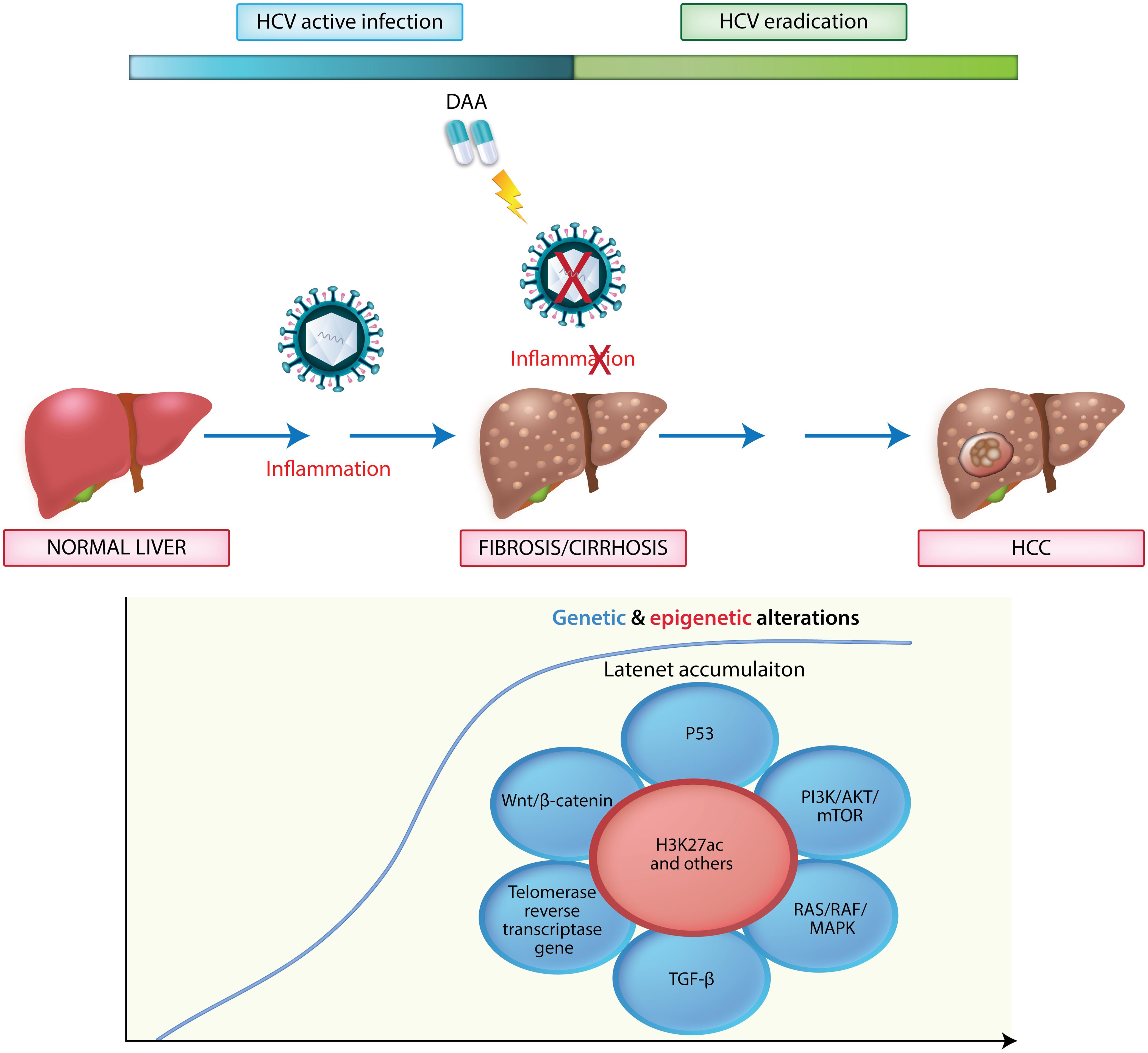 Pathogenesis of HCC development in HCV patients who achieve SVR by DAA.