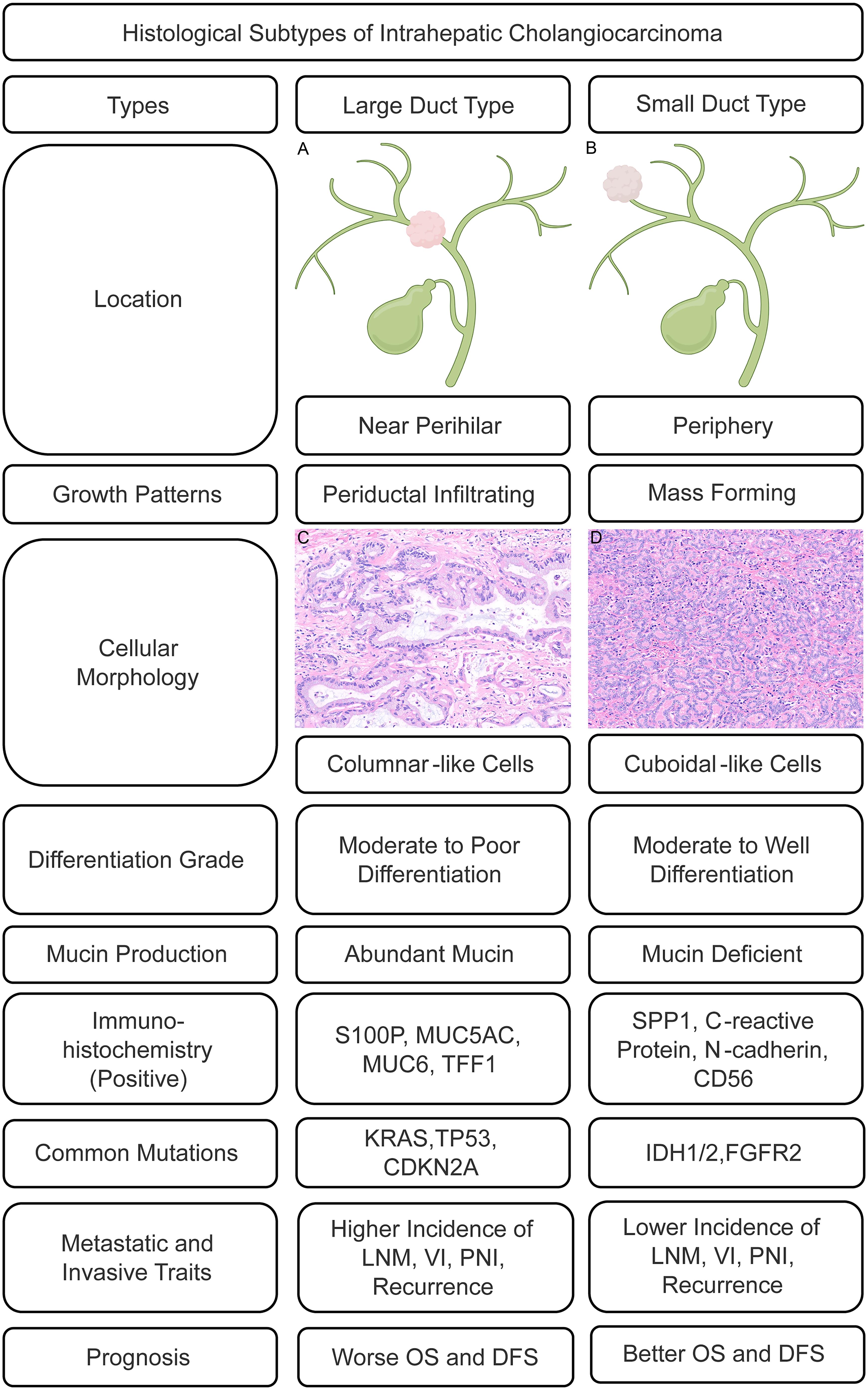 The figure summarizes the characteristics of the histological types of iCCA.