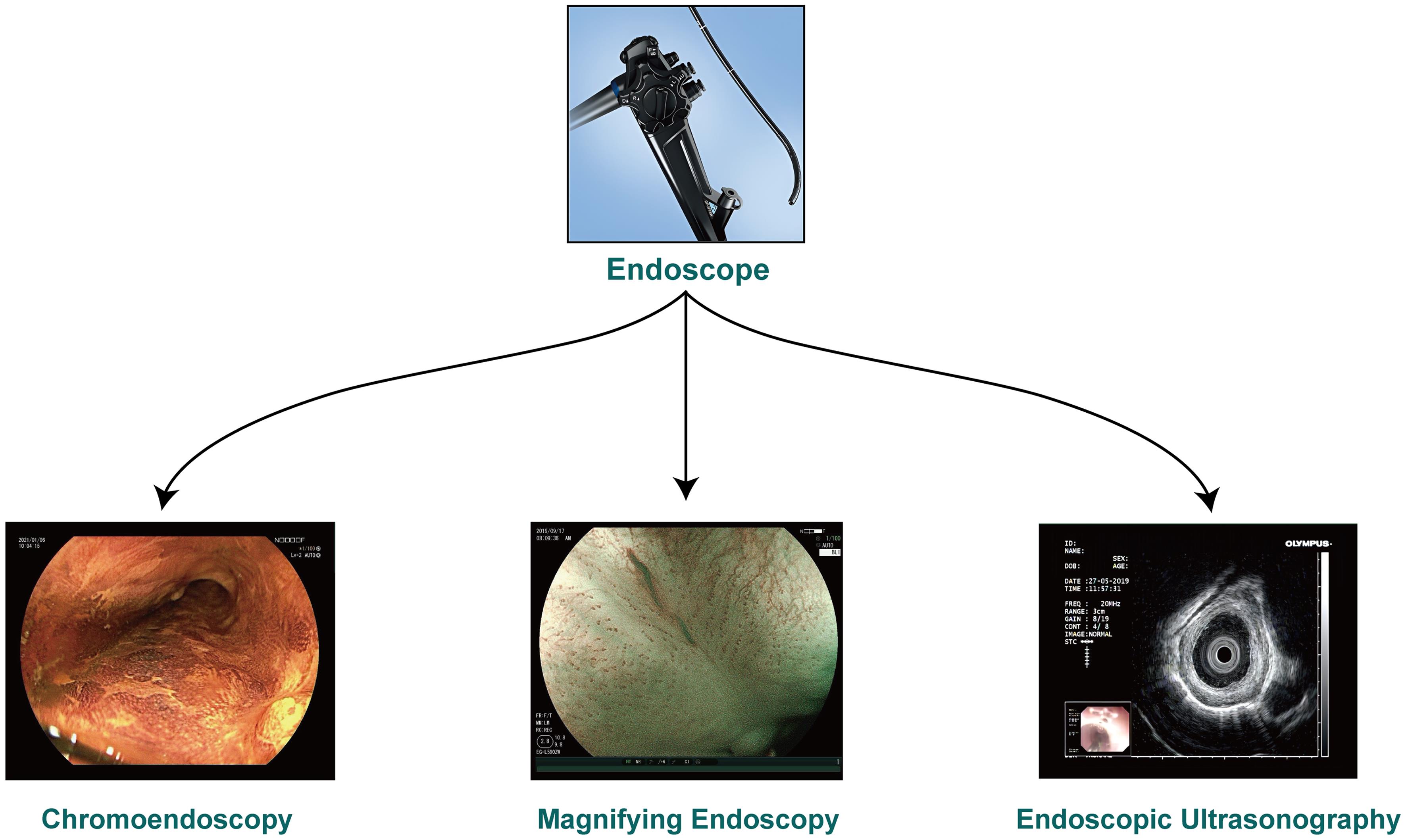 Classification of endoscopy.