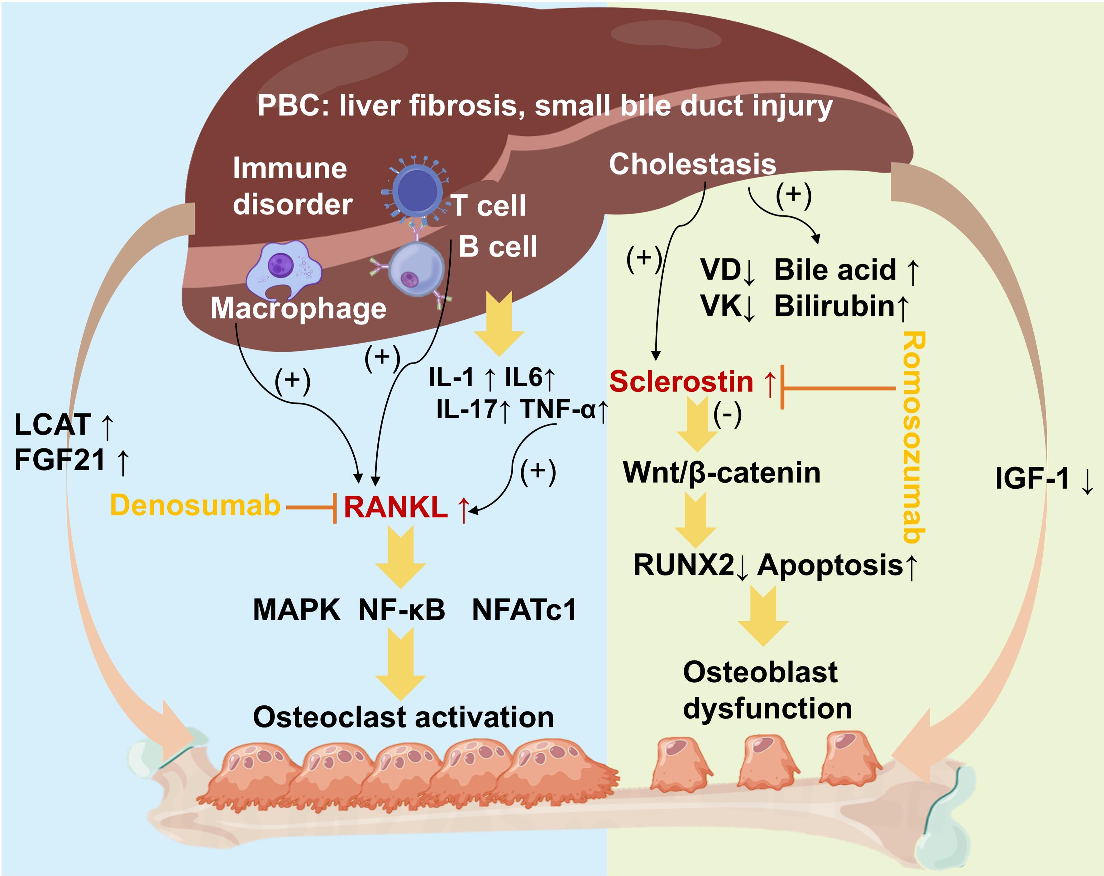 Major factors in the pathogenesis of osteoporosis in PBC.