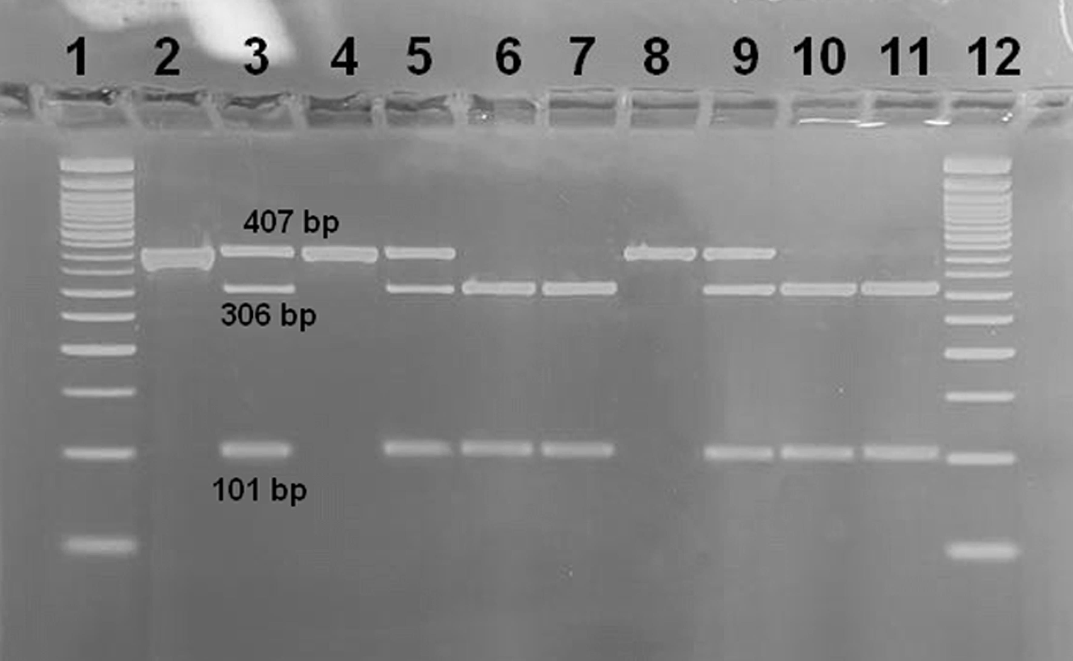 Agarose gel showing RFLP analysis of the <italic>TNFSF15 rs4979462</italic> variant.