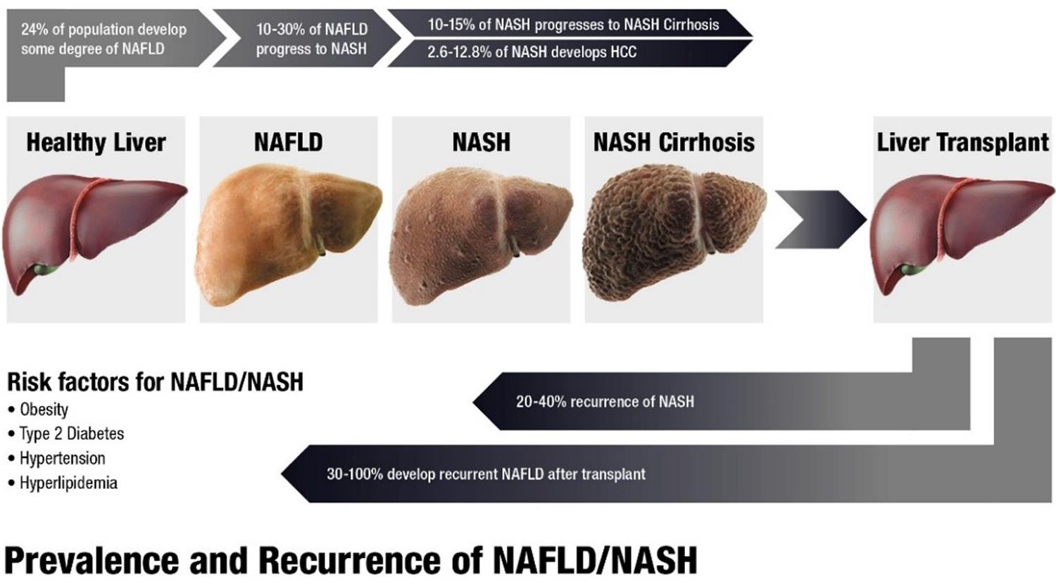 Natural history of nonalcoholic fatty liver disease/nonalcoholic steatohepatitis and recurrence after liver transplantation.