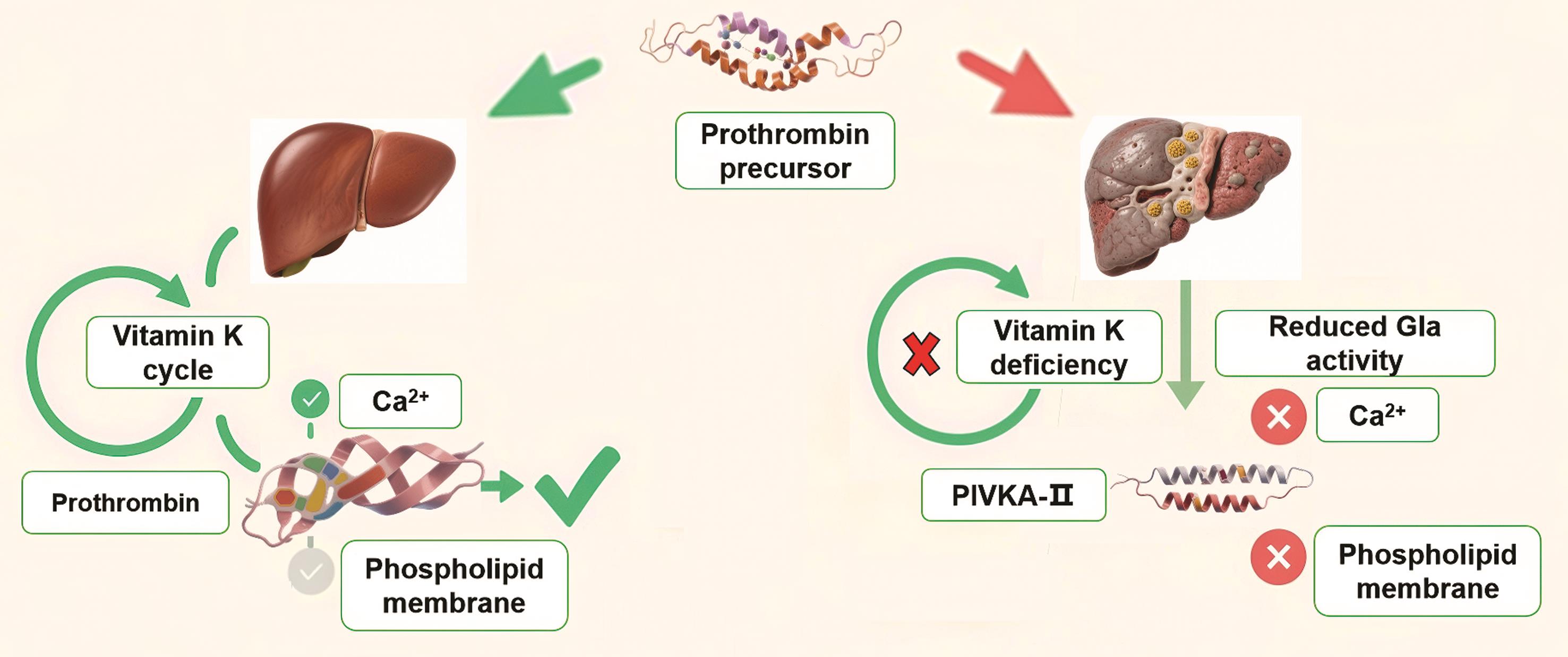 Biological significance and characteristics of PIVKA-II.