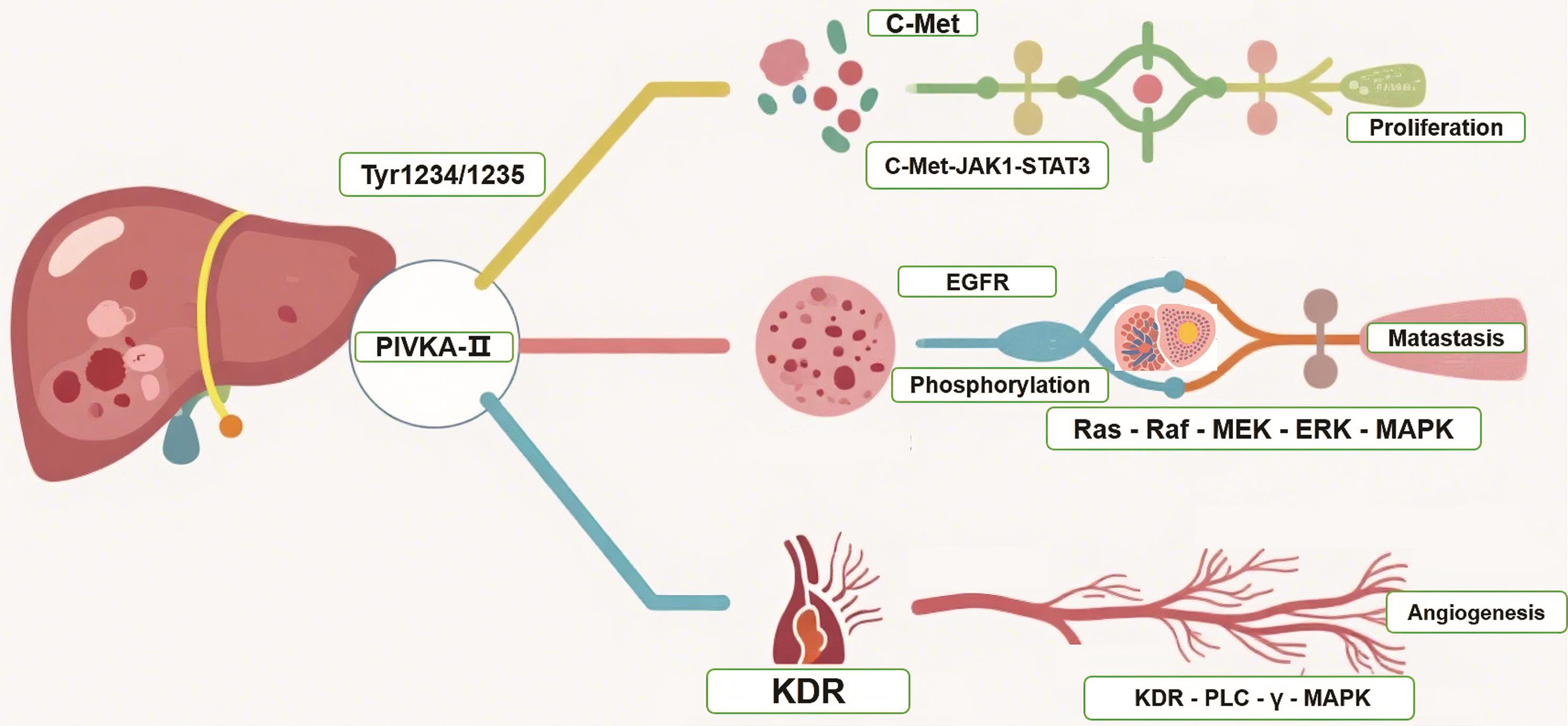 PIVKA-II promotes HCC progression.