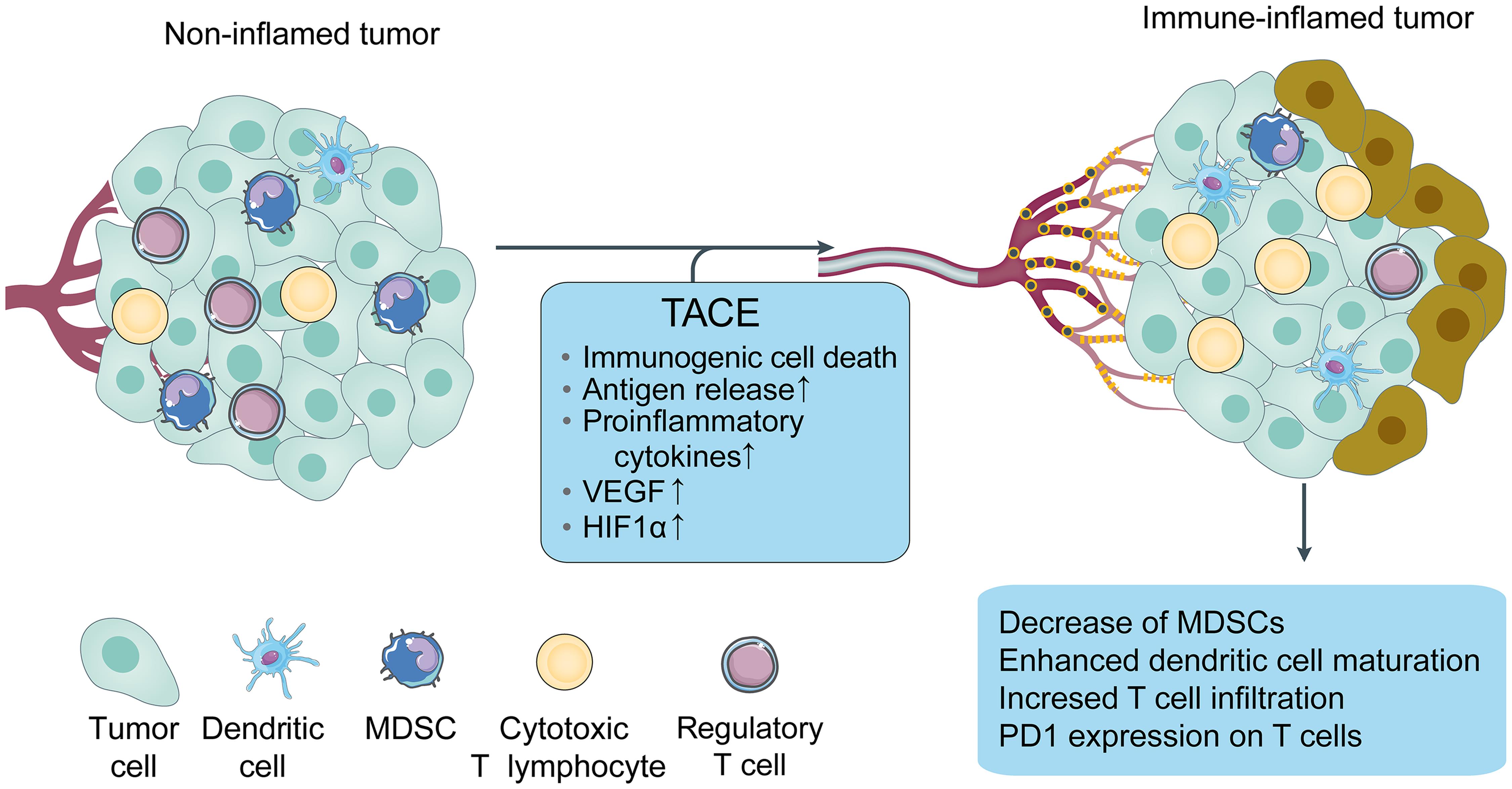 Possible mechanisms by which TACE and combination therapies provide benefit in HCC treatment.