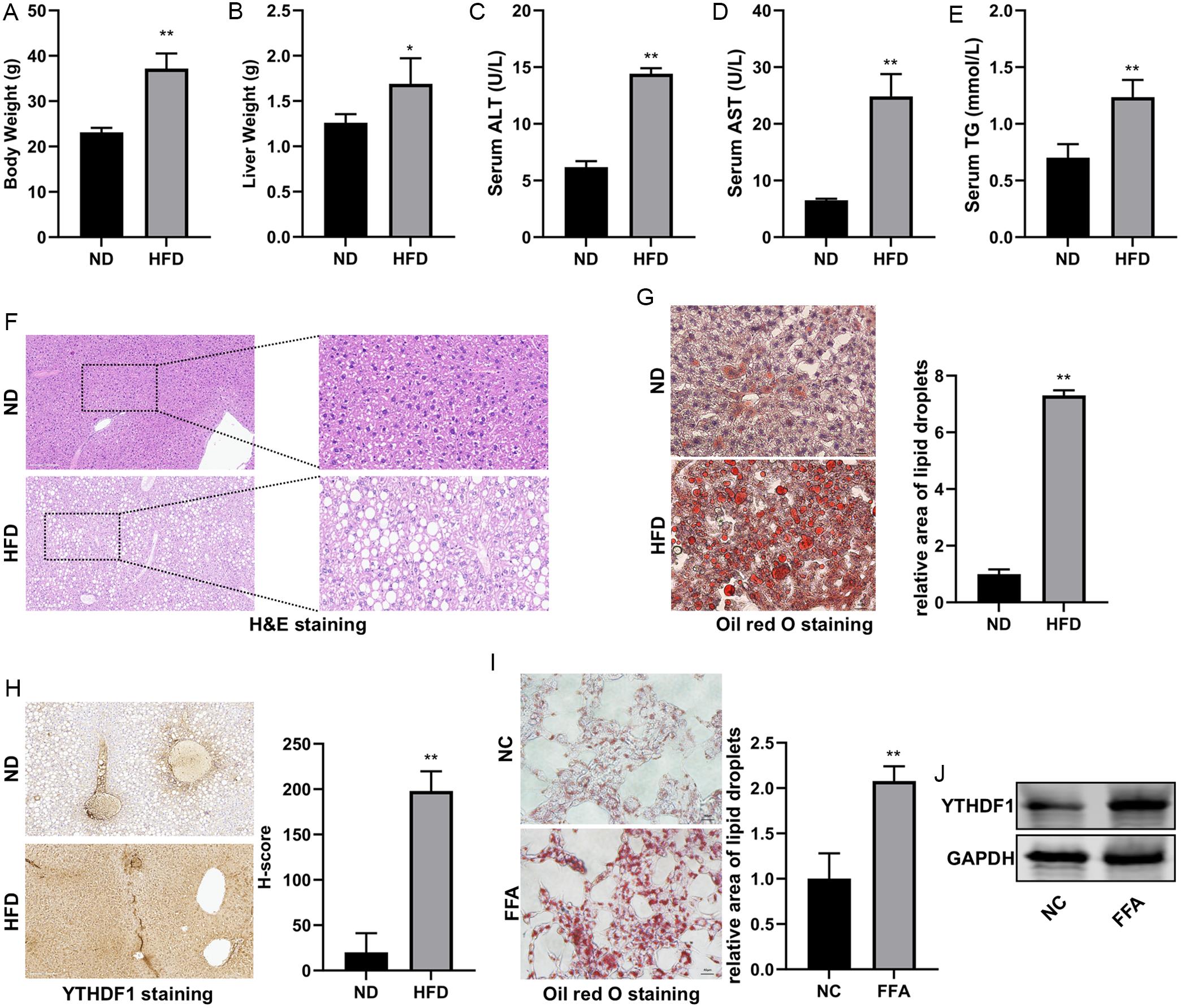 Validation of YTHDF1 Expression in Experimental NAFLD Models.