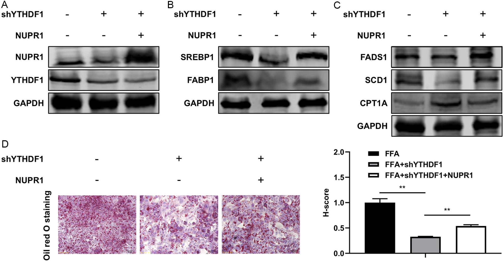 Effect of NUPR1 overexpression on YTHDF1 knockdown-induced suppression of lipid accumulation.