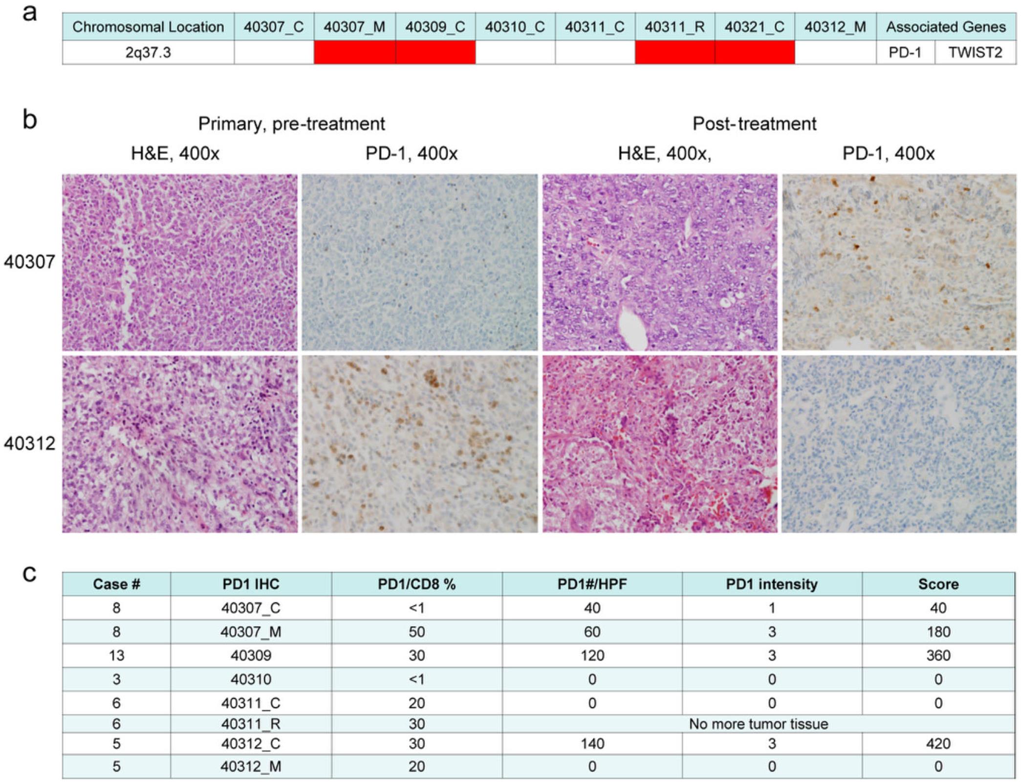 <italic>PD-1</italic> gain and PD-1 immunohistochemistry (IHC) in malignant rhabdoid tumors.