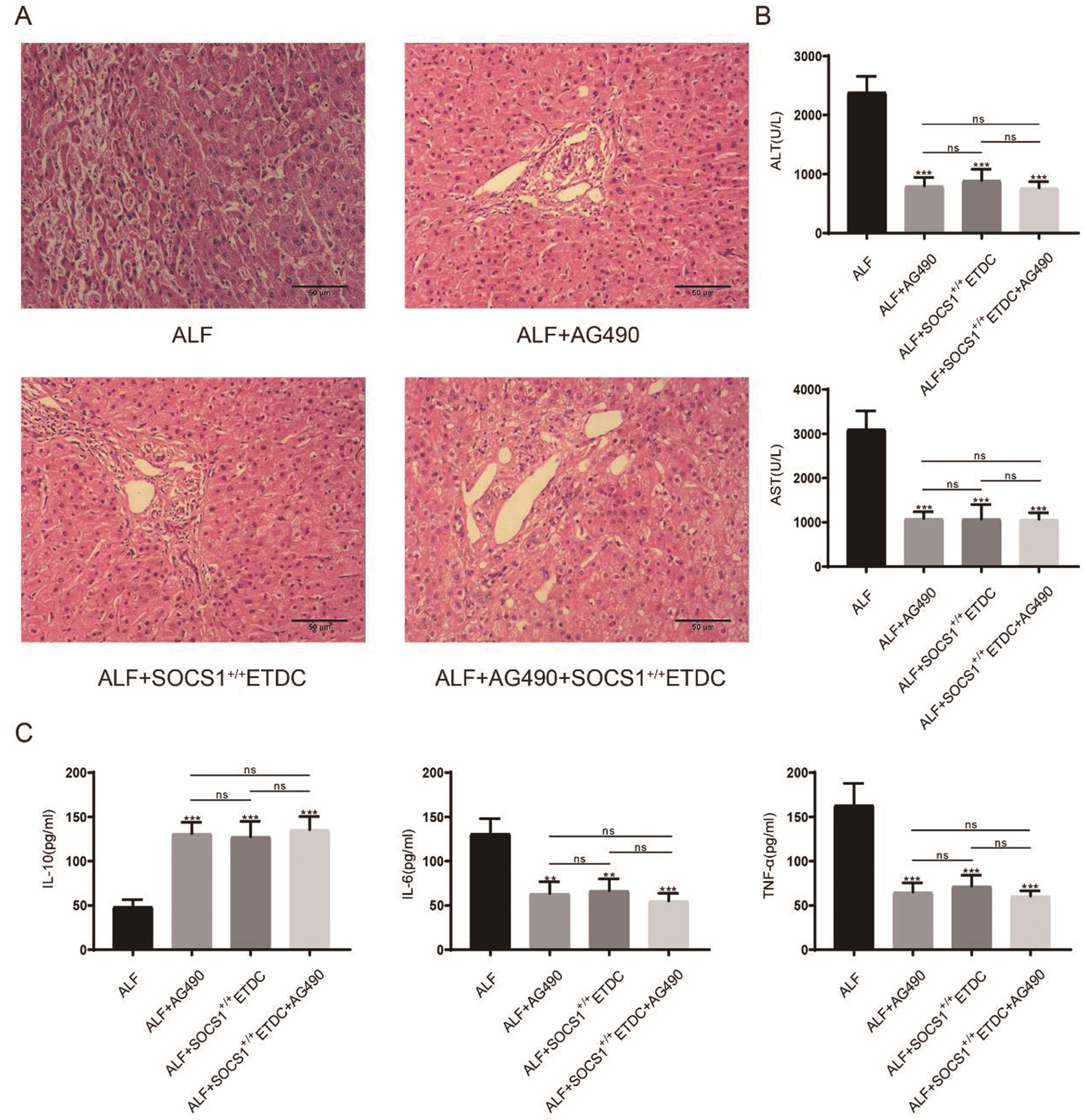 AG490 or SOCS1<sup>+/+</sup>ETDCs protect against liver injury induced by LPS/D-GalN and affect serum levels of inflammatory cytokines.