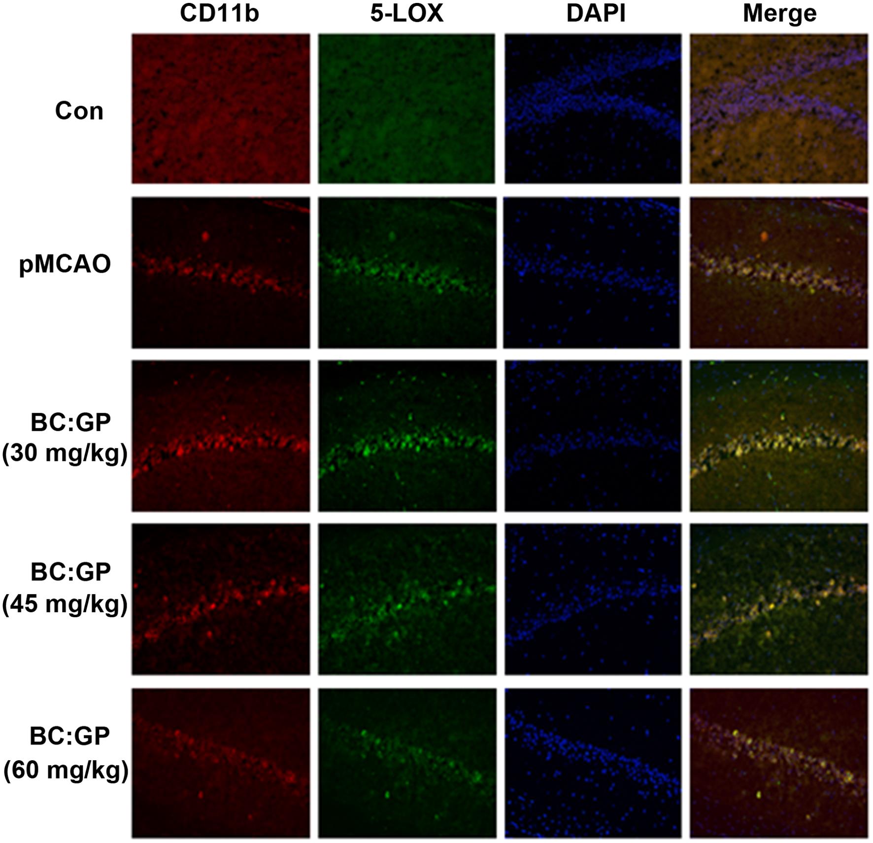 Effect of the BC/GP combination (7:3) on microglia and 5-LOX expression in the brain tissue of pMCAO rats (7 d).