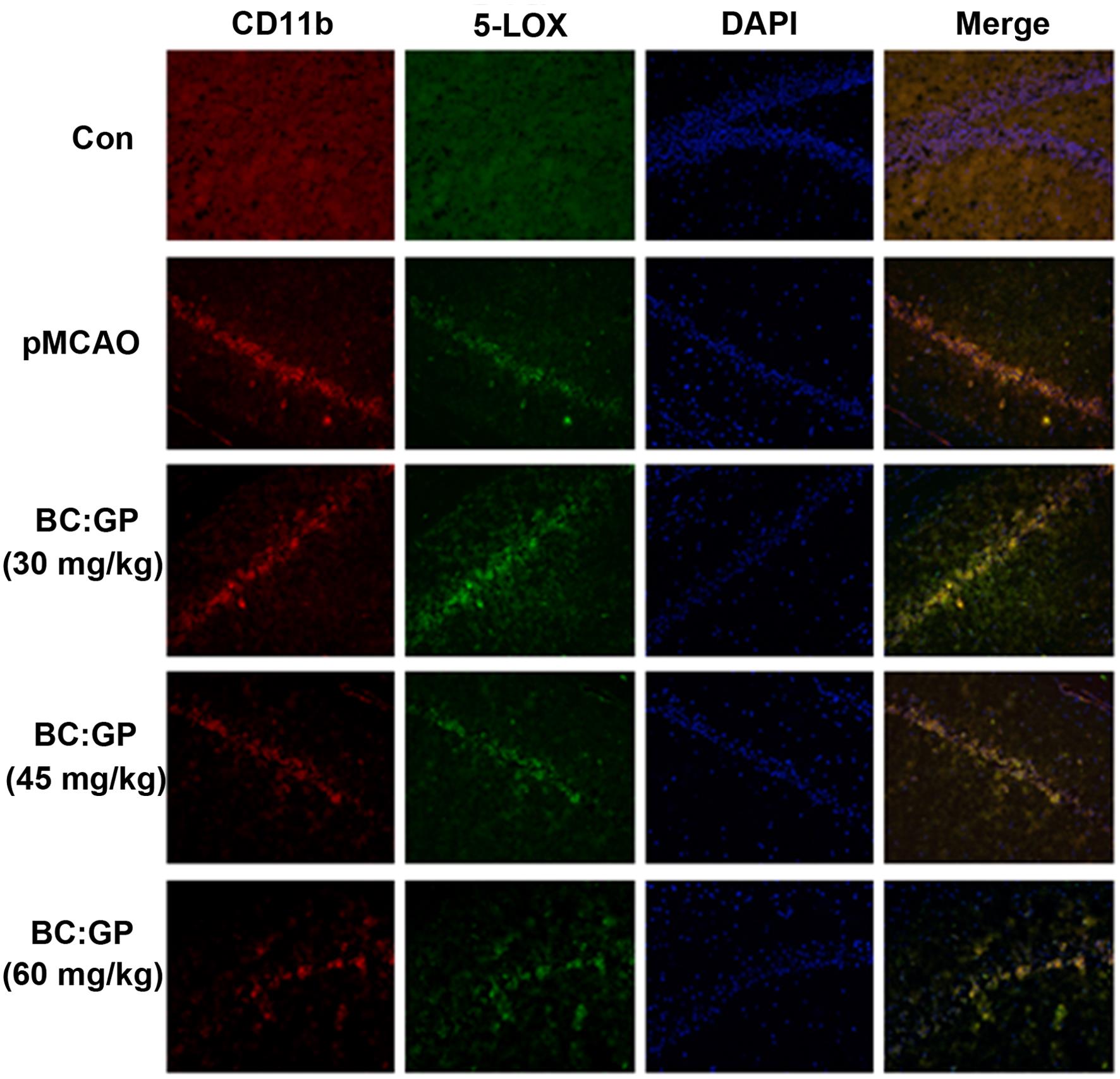 Effect of the BC/GP combination (7:3) on microglia and 5-LOX expression in the brain tissue of pMCAO rats (14 d).