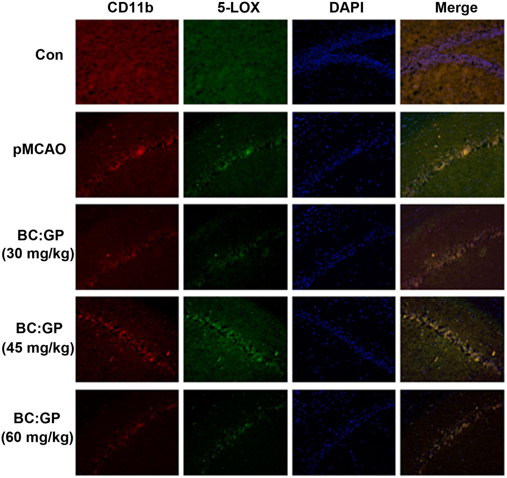 Effect of the BC/GP combination (7:3) on microglia and 5-LOX expression in the brain tissue of pMCAO rats (21 d).