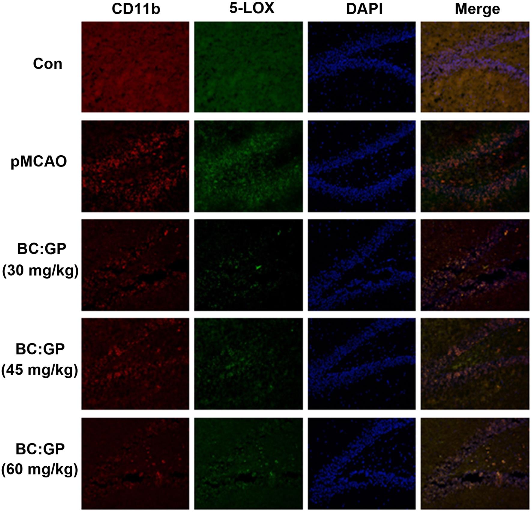 Effect of the BC/GP combination (7:3) on microglia and 5-LOX expression in the brain tissue of pMCAO rats (28 d).
