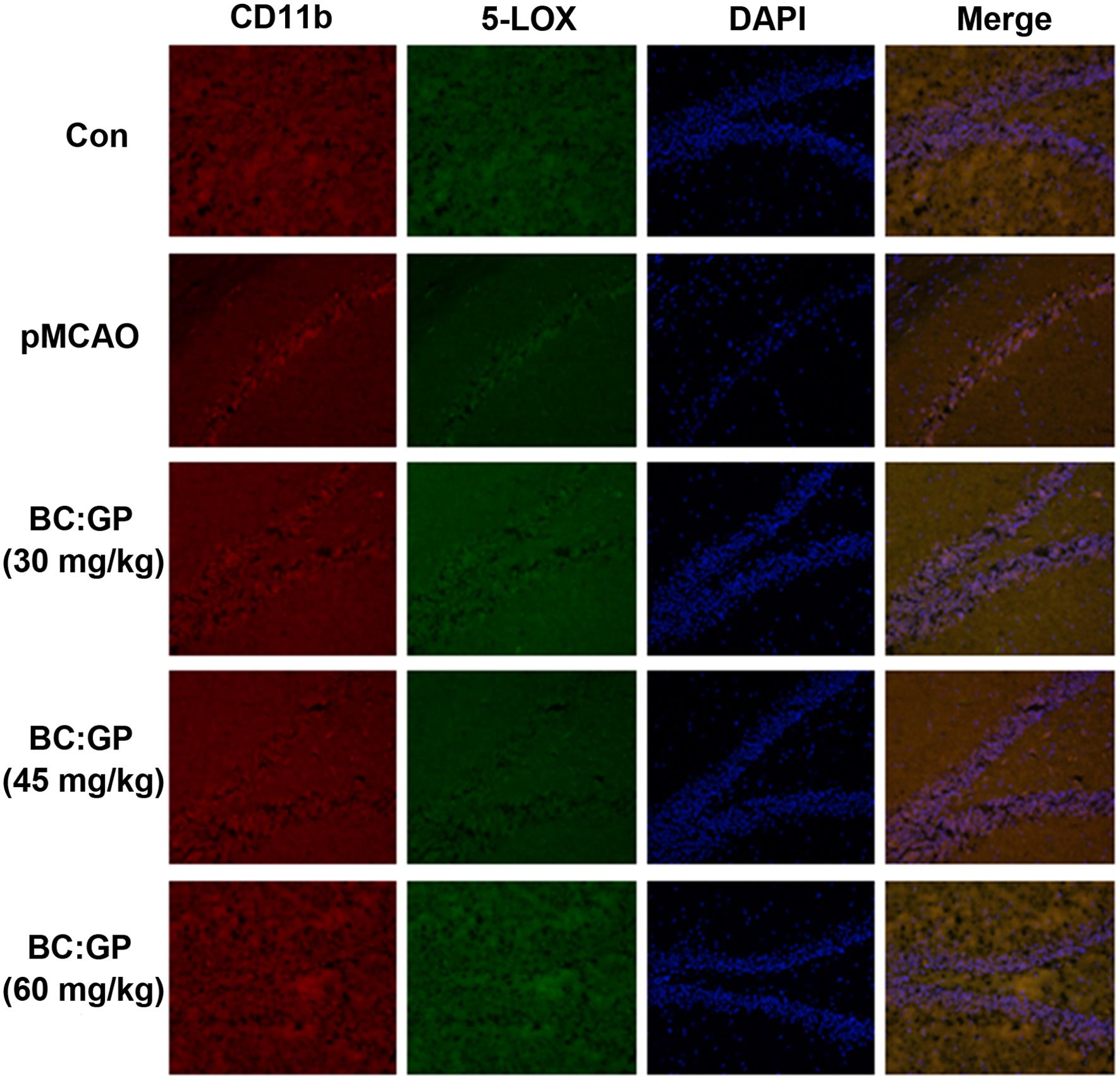 Effect of the BC/GP combination (7:3) on microglia and 5-LOX expression in the brain tissue of pMCAO rats (35 d).