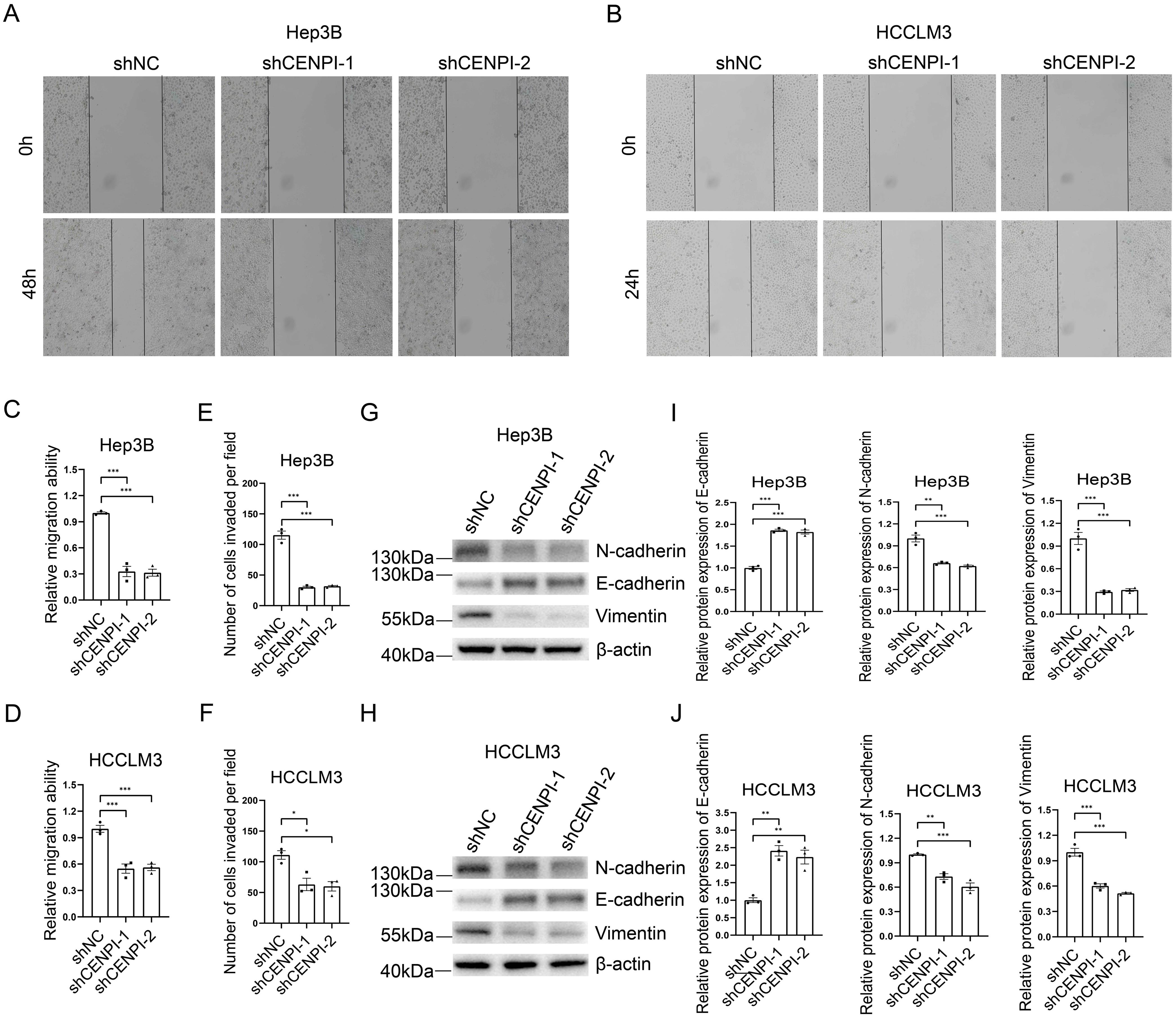 The effect of CENPI knockdown on migration, invasion, and EMT of HCC cells.