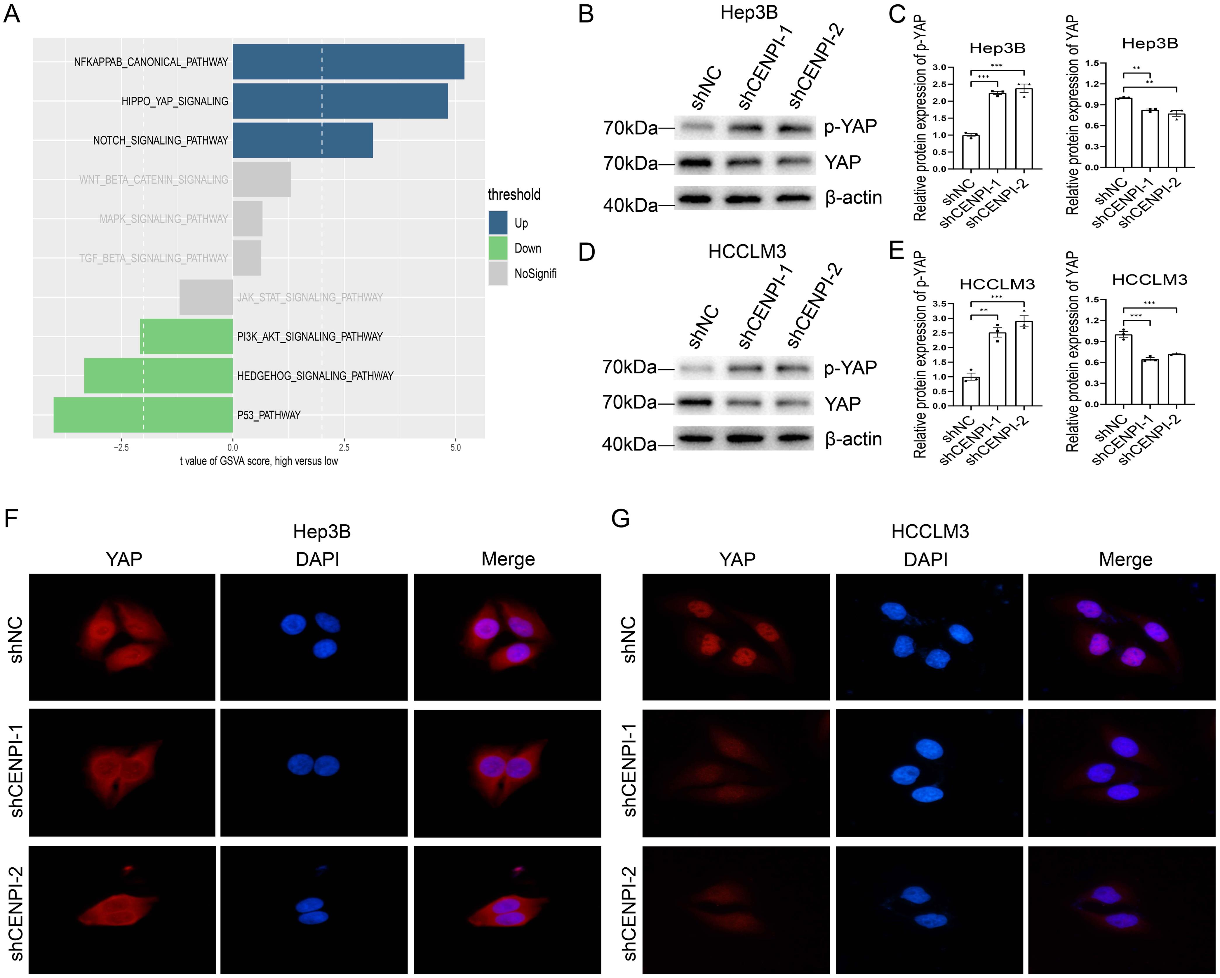 The effect of CENPI knockdown on the Hippo signaling pathway in HCC cells.